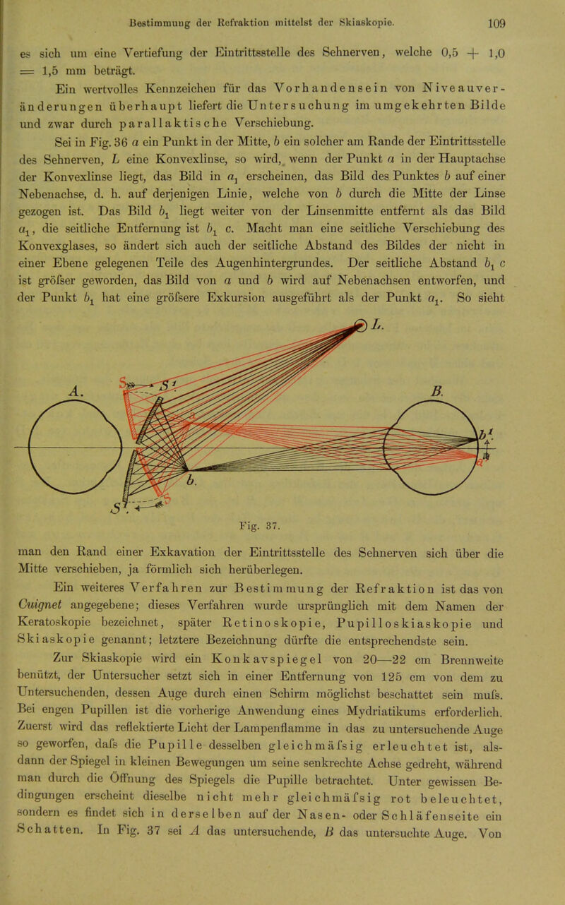 es sich um eine Vertiefung der Eintrittsstelle des Sehnerven, welche 0,5 -|- 1>0 = 1,5 mm beträgt. Ein wertvolles Kennzeichen für das Vorhandensein von Niveau Ver- änderungen überhaupt liefert die Untersuchung im umgekehrten Bilde und zwar durch parallaktische Verschiebung. Sei in Fig. 36 a ein Punkt in der Mitte, b ein solcher am Rande der Eintrittsstelle des Sehnerven, L eine Konvexlinse, so wird, wenn der Punkt a in der Hauptachse der Konvexlinse liegt, das Bild in erscheinen, das Bild des Punktes b auf einer Nebenachse, d. h. auf derjenigen Linie, welche von h durch die Mitte der Linse gezogen ist. Das Bild b^ liegt weiter von der Linsenmitte entfernt als das Bild u^, die seitliche Entfernung ist b^ c. Macht man eine seitliche Verschiebung des Konvexglases, so ändert sich auch der seitliche Abstand des Bildes der nicht in einer Ebene gelegenen Teile des Augenhintergrundes. Der seitliche Abstand c ist gröfser geworden, das Bild von a und 6 wird auf Nebenachsen entworfen, und der Punkt b^ hat eine gröfsere Exkursion ausgeführt als der Punkt o^. So sieht Fig. 37. man den Rand einer Exkavation der Eintrittsstelle des Sehnerven sich über die Mitte verschieben, ja förmlich sich herüberlegen. Ein weiteres Verfahren zur Bestimmung der Refraktion ist das von Cuignet angegebene; dieses Verfahren wurde ursprünglich mit dem Namen der Keratoskopie bezeichnet, später Retinoskopie, Pupilloskiaskopie und Skiaskopie genannt; letztere Bezeichnung dürfte die entsprechendste sein. Zur Skiaskopie wird ein Konkavspiegel von 20—22 cm Brennweite benützt, der Untersucher setzt sich in einer Entfernung von 125 cm von dem zu Untersuchenden, dessen Auge durch einen Schirm möglichst beschattet sein mufs. Bei engen Pupillen ist die vorherige Anwendung eines Mydriatikums erforderlich. Zuerst wird das reflektierte Licht der Lampenflamme in das zu untersuchende Auge so geworfen, dafs die Pupille desselben gleichmäfsig erleuchtet ist, als- dann der Spiegel in kleinen Bewegungen um seine senkrechte Achse gedreht, während man durch die Öff'nung des Spiegels die Pupille betrachtet. Unter gewissen Be- dingungen erscheint dieselbe nicht mehr gleichmäfsig rot beleuchtet, sondern es findet sich in derselben auf der Nasen- oder Sehläfenseite ein Schatten. In Fig. 37 sei A das untersuchende, B das untersuchte Auge. Von