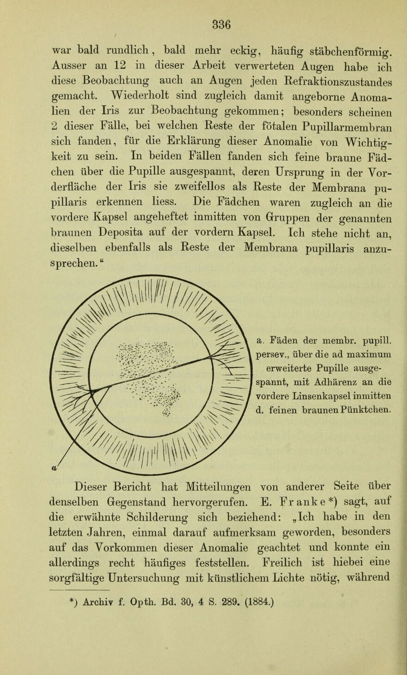 B36 war bald rundlich, bald mehr eckig, häufig stäbchenförmig. Ausser an 12 in dieser Arbeit verwerteten Augen habe ich diese Beobachtung auch an Augen jeden Refraktionszustandes gemacht. Wiederholt sind zugleich damit angeborne Anoma- lien der Iris zur Beobachtung gekommen; besonders scheinen 2 dieser Fälle, bei welchen Reste der fötalen Pupillarmembran sich fanden, für die Erklärung dieser Anomalie von Wichtig- keit zu sein. In beiden Fällen fanden sich feine braune Fäd- chen über die Pupille ausgespannt, deren Ursprung in der Vor- derfläche der Iris sie zweifellos als Reste der Membrana pu- pillaris erkennen Hess. Die Fädchen waren zugleich an die vordere Kapsel angeheftet inmitten von Gruppen der genannten braunen Deposita auf der vordem Kapsel. Ich stehe nicht an, dieselben ebenfalls als Reste der Membrana pupillaris anzu- sprechen.  a. Fäden der membr. pupill. persev., über die ad maximum erweiterte Pupille ausge- spannt, mit Adhärenz an die vordere Linsenkapsel inmitten d. feinen braunen Pünktchen. Dieser Bericht hat Mitteilungen von anderer Seite über denselben Gegenstand hervorgerufen. E. Franke*) sagt, auf die erwähnte Schilderung sich beziehend: „Ich habe in den letzten Jahren, einmal darauf aufmerksam geworden, besonders auf das Vorkommen dieser Anomalie geachtet und konnte ein allerdings recht häufiges feststellen. Freilich ist hiebei eine sorgfältige Untersuchung mit künstlichem Lichte nötig, während