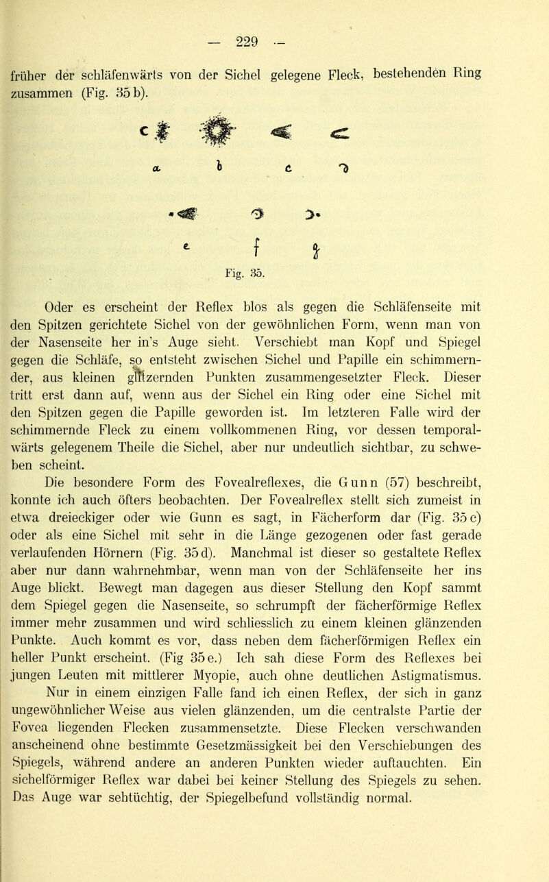 früher der schläfenwärts von der Sichel gelegene Fleck, bestehenden Ring zusammen (Fig. 85 b). OL l c f t Fig. 35. Oder es erscheint der Reflex blos als gegen die Schläfenseite mit den Spitzen gerichtete Sichel von der gewöhnlichen Form, wenn man von der Nasenseite her in's Auge sieht. Verschiebt man Kopf und Spiegel gegen die Schläfe, so entsteht zwischen Sichel und Papille ein schimmern- der, aus kleinen glitzernden Punkten zusammengesetzter Fleck. Dieser tritt erst dann auf, wenn aus der Sichel ein Ring oder eine Sichel mit den Spitzen gegen die Papille geworden ist. Im letzteren Falle wird der schimmernde Fleck zu einem vollkommenen Ring, vor dessen temporal- wärts gelegenem Theile die Sichel, aber nur undeutlich sichtbar, zu schwe- ben scheint. Die besondere Form des Fovealreflexes, die Gunn (57) beschreibt, konnte ich auch öfters beobachten. Der Fovealreflex stellt sich zumeist in etwa dreieckiger oder wie Gunn es sagt, in Fächerform dar (Fig. 35 c) oder als eine Sichel mit sehr in die Länge gezogenen oder fast gerade verlaufenden Hörnern (Fig. 35 d). Manchmal ist dieser so gestaltete Reflex aber nur dann wahrnehmbar, wenn man von der Schläfenseite her ins Auge blickt. Rewegt man dagegen aus dieser Stellung den Kopf sammt dem Spiegel gegen die Nasenseite, so schrumpft der fächerförmige Reflex immer mehr zusammen und wird schliesslich zu einem kleinen glänzenden Punkte. Auch kommt es vor, dass neben dem fächerförmigen Reflex ein heller Punkt erscheint. (Fig 35 e.) Ich sah diese Form des Reflexes bei jungen Leuten mit mittlerer Myopie, auch ohne deutlichen Astigmatismus. Nur in einem einzigen Falle fand ich einen Reflex, der sich in ganz ungewöhnlicher Weise aus vielen glänzenden, um die centralste Partie der Fovea liegenden Flecken zusammensetzte. Diese Flecken verschwanden anscheinend ohne bestimmte Gesetzmässigkeit bei den Verschiebungen des Spiegels, während andere an anderen Punkten wieder auftauchten. Ein sichelförmiger Reflex war dabei bei keiner Stellung des Spiegels zu sehen. Das Auge war sehtüchtig, der Spiegelbefund vollständig normal.