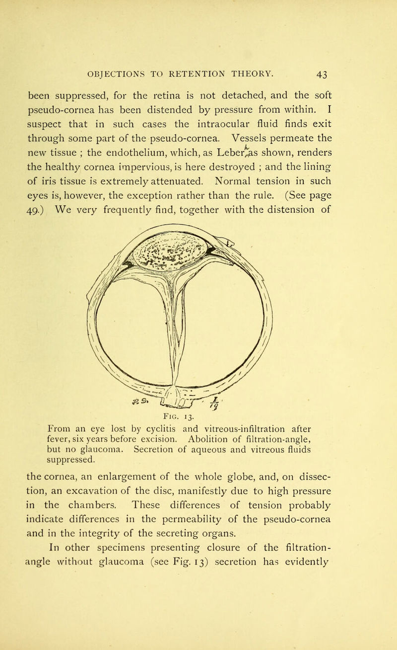 been suppressed, for the retina is not detached, and the soft pseudo-cornea has been distended by pressure from within. I suspect that in such cases the intraocular fluid finds exit through some part of the pseudo-cornea. Vessels permeate the new tissue ; the endothelium, which, as Leberias shown, renders the healthy cornea impervious, is here destroyed ; and the lining of iris tissue is extremely attenuated. Normal tension in such eyes is, however, the exception rather than the rule. (See page 49.) We very frequently find, together with the distension of From an eye lost by cyclitis and vitreous-infiltration after fever, six years before excision. Abolition of filtration-angle, but no glaucoma. Secretion of aqueous and vitreous fluids suppressed. the cornea, an enlargement of the whole globe, and, on dissec- tion, an excavation of the disc, manifestly due to high pressure in the chambers. These differences of tension probably indicate differences in the permeability of the pseudo-cornea and in the integrity of the secreting organs. In other specimens presenting closure of the filtration- angle without glaucoma (see Fig. 13) secretion has evidently Fig. 13.