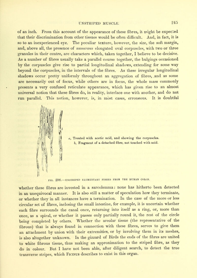 of an inch. From this account of the appearance of these fibres, it might be expected that their discrimination from other tissues would be often difficult. And, in fact, it is so to an inexperienced eye. The peculiar texture, however, the size, the soft margin, and, above all, the presence of numerous elongated oval corpuscles, with two or three granules in their centre, are characters which, taken together, I believe to be decisive. As a number of fibres usually take a parallel course together, the bulgings occasioned by the corpuscles give rise to partial longitudinal shadows, extending for some way beyond the corpuscles, in the intervals of the fibres. As these irregular longitudinal shadows occur pretty uniformly throughout an aggregation of fibres, .and as some are necessarily out of focus, while others are in focus, the whole mass commonly presents a very confused reticulate appearance, which has given rise to an almost universal notion that these fibres do, in reality, interlace one with another, and do not run parallel. This notion, however, is, in most cases, erroneous. It is doubtful a, Treated with acetic acid, and showing the corpuscles. b, Fragment of a detached fibre, not touched with acid. FIG. 298.—UNSTEIPEP ELEMENTARY FIBRES FROM THE HUMAN COLON. whether these fibres are invested in a sarcolemma: none has hitherto been detected in an unequivocal manner. It is also still a matter of speculation how they terminate, or whether they in all instances have a termination. In the case of the more or less circular set of fibres, inclosing the small intestine, for example, it is uncertain whether each fibre surrounds the canal once, returning into itself as a ring, or, more than once, as a spiral, or whether it passes only partially round it, the rest of the circle being completed by others. Whether the areolar tissue (the representative of the fibrous) that is always found in connection with these fibres, serves to give them an attachment by union with their extremities, or by involving them in its meshes, is also altogether unknown. In the gizzard of Birds the ends of the fibres are united to white fibrous tissue, thus making an approximation to the striped fibre, as they do in colour. But I have not been able, after diligent search, to detect the true transverse stripes, which Ficinus describes to exist in this organ.