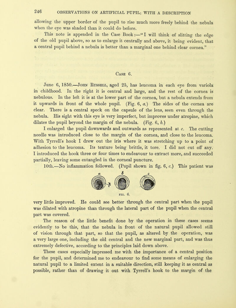 allowing the upper border of the pupil to rise much more freely behind the nebula when the eye was shaded than it could do before. This note is appended in the Case Book:—I will think of slitting the edge of the old pupil above, so as to enlarge it centrally and above, it being evident, that a central pupil behind a nebula is better than a marginal one behind clear cornea. Case 6. June 6, 1850.—John Eussell, aged 25, has leucoma in each eye from variola in childhood. In the right it is central and large, and the rest of the cornea is nebulous. In the left it is at the lower part of the cornea, but a nebula extends from it upwards in front of the whole pupil. (Fig. 6, a.) The sides of the cornea are clear. There is a central speck on the capsule of the lens, seen even through the nebula. His sight with this eye is very imperfect, but improves under atropine, which dilates the pupil beyond the margin of the nebula. (Fig. 6, b.) I enlarged the pupil downwards and outwards as represented at c. The cutting needle was introduced close to the margin of the cornea, and close to the leucoma. With Tyrrell's hook I drew out the iris where it was stretching up to a point of adhesion to the leucoma. Its texture being brittle, it tore. I did not cut off any. I introduced the hook three or four times to endeavour to extract more, and succeeded partially, leaving some entangled in the corneal puncture. 10th.—No inflammation followed. (Pupil shown in fig. 6, c.) This patient was FIG. 6. very little improved. He could see better through the central part when the pupil was dilated with atropine than through the lateral part of the pupil when the central part was covered. The reason of the little benefit done by the operation in these cases seems evidently to be this, that the nebula in front of the natural pupil allowed still of vision through that part, so that the pupil, as altered by the operation, was a very large one, including the old central and the new marginal part, and was thus extremely defective, according to the principles laid down above. These cases especially impressed me with the importance of a central position for the pupil, and determined me to endeavour to find some means of enlarging the natural pupil to a limited extent in a suitable direction, still keeping it as central as possible, rather than of drawing it out with Tyrrell's hook to the margin of the