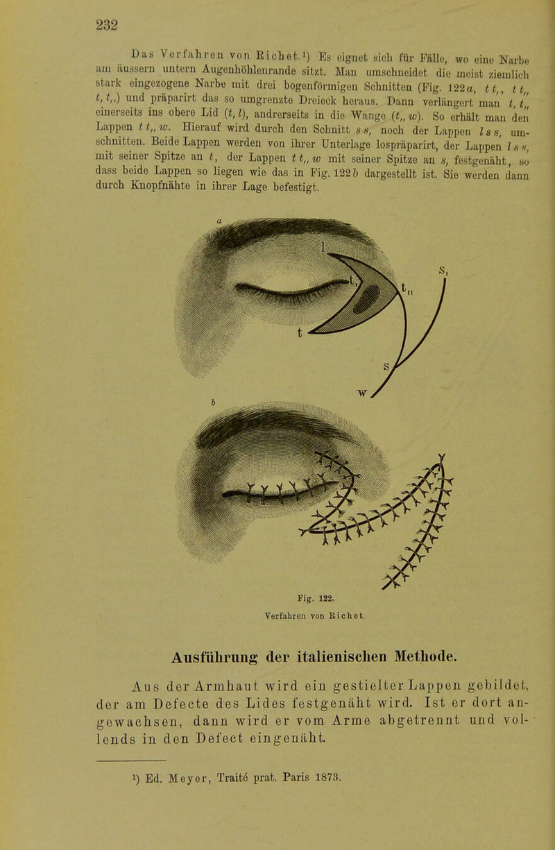 Das Verfallrou von Ricliof.’) Es eignet sich l'ür Fälle, wo eine Narbe am äussern untern Augenhölilenrande sitzt. Man umschneidet die meist ziemlich stark eingezogene Narbe mit drei bogenförmigen Schnitten (Pig. 122 a, tt,, tt„ t, t,,) und präparirt das so umgrenzte Dreieck heraus. Dann verlängert man t, t„ einerseits ins obere Lid {t, l), andrerseits in die Wange {t„ w). So erhält man den Lappen 11„ tv. Hierauf wird durch den Schnitt s s, noch der Lappen l s s, Um- schnitten. Beide Lappen werden von ihrer Unterlage lospräparirt, der Lappen l s s, mit seiner Spitze an t, der Lappen tt„w mit seiner Spitze an s, festgenäht, so dass beide Lappen so liegen wie das in Fig. 122 ö dargestellt ist. Sie werden dann durch Kuopfnähte in ihrer Lage befestigt. Fig. 122. Verfahren von Rieh et. Ausfüliriiiig der italienischen Methode. Aus der Ariniiaut wird ein gestielter Lappen gebildet, der am Defecte des Lides festgenälit wird. Ist er dort an- gewachsen, dann wird er vom Arme abgetrennt und vol- lends in den Defect eingenäht. 1) Ed. Meyer, Tratte prat. Paris 1873.