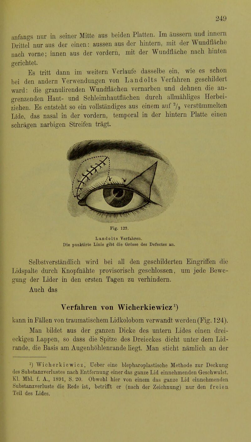 aiiffing's nur in sciiiGr Mitte aus beiden Platten. Im äussein und innein Drittel nur aus der einen: aussen aus der hintern, mit der Wundfläche nach vorne; innen aus der vordem, mit der Wundfläche nach hinten gerichtet. Es tritt dann im weitern Verlaufe dasselbe ein, wie es schon bei den andern Verwendungen von Landolts Verfahren geschildert ward: die granulirenden Wundflächen vernarben und dehnen die an- grenzenden Haut- und Schleimhautflächen durch allmähliges Herbei- ziehen. Es entsteht so ein vollständiges aus einem auf Vg verstümmelten Lide, das nasal in der vordem, temporal in der hintern Platte einen schi’ägen narbigen Streifen trägt. Fig. 123. Landolts Verfahren. Die punktirte Linie gibt die Grösse des Defectes an. Selbstverständlich wird bei all den geschilderten Eingrilien die Lidspalte durch Knopfnähte provisorisch geschlossen, um jede Bewe- gung der Lider in den ersten Tagen zu verhindern. Auch das Verfahren von Wicherkiewicz^) kann in Fällen von traumatischem Lidkolobom verwandt werden (Pig. 124). Man bildet aus der ganzen Dicke des untern Lides einen drei- eckigen Lappen, so dass die Spitze des Dreieckes dicht unter dem Lid- rande, die Basis am Augenhöhlenrande hegt. Man sticht nämlich an der 1) Wicherkiewicz, Ueber eine blepharoplastische Methode zur Deckung des Substanzverlustes nach Entfernung einer das ganze Lid einnehmenden Geschwulst. Kl. Mbl. f. A., 1891, S. 20. Obwohl hier von einem das ganze Lid einnehmenden Substanz Verluste die Eede ist, betrifft er (nach der Zeichnung) nur den freien Teil des Lides.