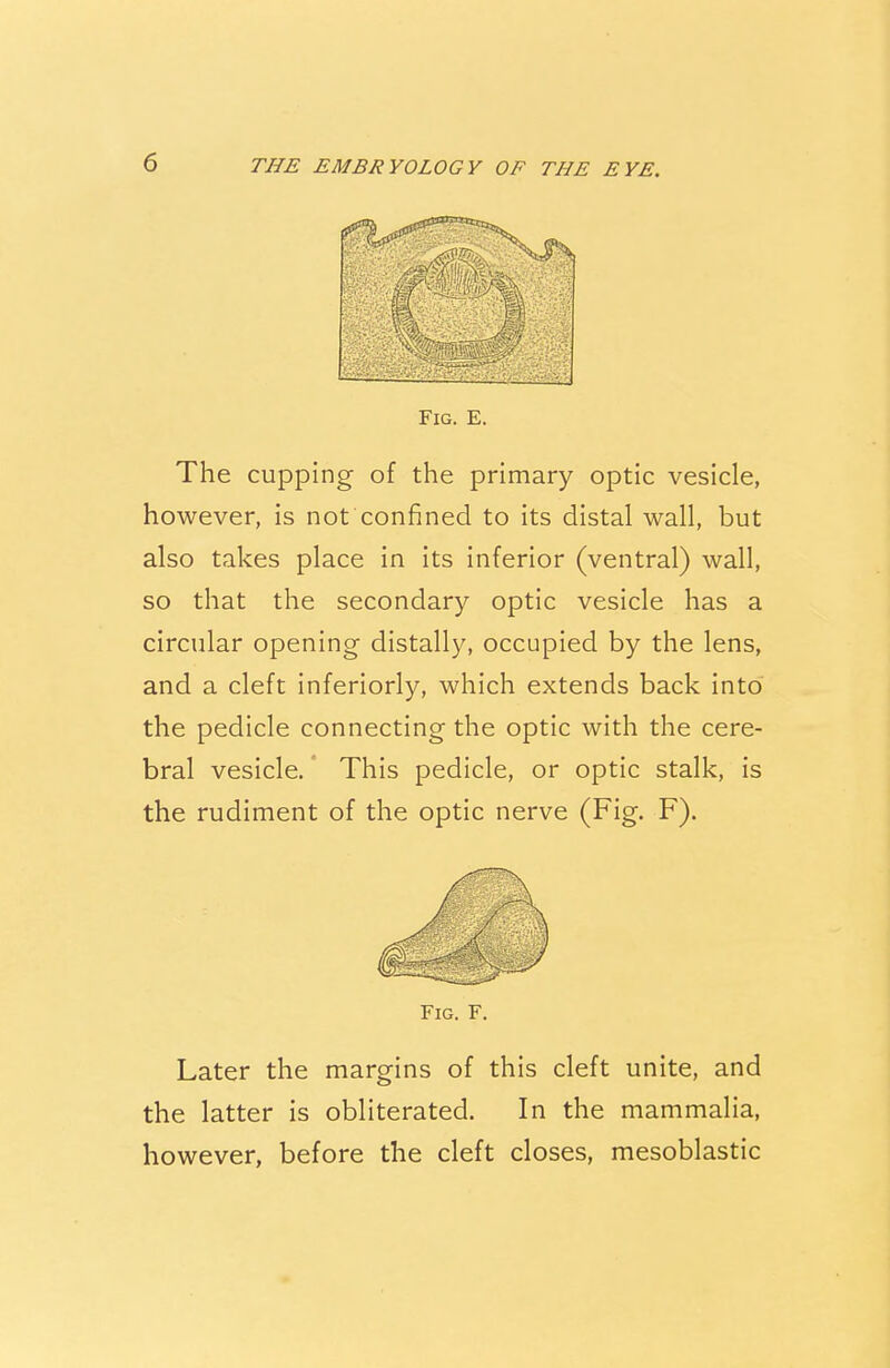 Fig. E. The cupping of the primary optic vesicle, however, is not confined to its distal wall, but also takes place in its inferior (ventral) wall, so that the secondary optic vesicle has a circular opening distally, occupied by the lens, and a cleft inferiorly, which extends back into the pedicle connecting the optic with the cere- bral vesicle. This pedicle, or optic stalk, is the rudiment of the optic nerve (Fig. F). Fig. F. Later the margins of this cleft unite, and the latter is obliterated. In the mammalia, however, before the cleft closes, mesoblastic