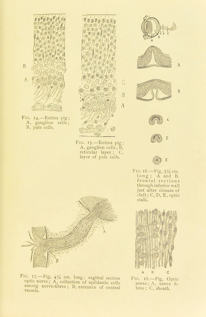 Fig. 14.—Retina pig ; A, ganglion cells; B, pale cells. Fig. 15.—Retina pig ; A, ganglion cells ; B, reticular layer; C, layer of pale cells. Fig. 16.—Pig, 3^ cm. long ; A and B. frontal sections through inferior wall just after closure of cleft; C, D, E, optic stalk. a B c Fig. 18.—Pig, Optic nerve ; A, nerve fi- bres ; C, sheath. V Fig. 17.—plgi Ay2 cm long . sagitta] section optic nerve ; A, collection of epiblastic cells among nerve-fibres ; B, entrance of central vessels.