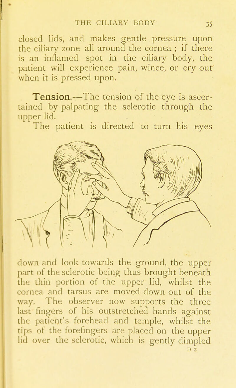 closed lids, and makes gentle pressure upon the ciliary zone all around the cornea ; if there is an inflamed spot in the ciliary body, the patient will experience pain, wince, or cry out when it is pressed upon. Tension.—The tension of the eye is ascer- tained by palpating the sclerotic through the upper lid. The patient is directed to turn his eyes down and look towards the ground, the upper part of the sclerotic being thus brought beneath the thin portion of the upper lid, whilst the cornea and tarsus are moved down out of the way. The observer now supports the three last fingers of his outstretched hands against the patient's forehead and temple, whilst the tips of the forefingers are placed on the upper lid over the sclerotic, which is gently dimpled D 2