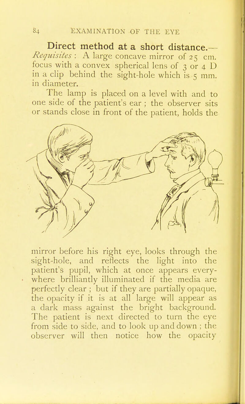 Direct method at a short distance.— Requisites : A large concave mirror of 25 cm. focus with a convex spherical lens of 3 or 4. D in a clip behind the sight-hole which is 5 mm. in diameter. The lamp is placed on a level with and to one side of the patient's ear ; the observer sits or stands close in front of the patient, holds the mirror before his right eye, looks through the sight-hole, and reflects the light into the patient's pupil, which at once appears every- where brilliantly illuminated if the media are perfectly clear ; but if they are partially opaque, the opacity if it is at all large will appear as a dark mass against the bright background. The patient is next directed to turn the eye from side to side, and to look up and down ; the observer will then notice how the opacity