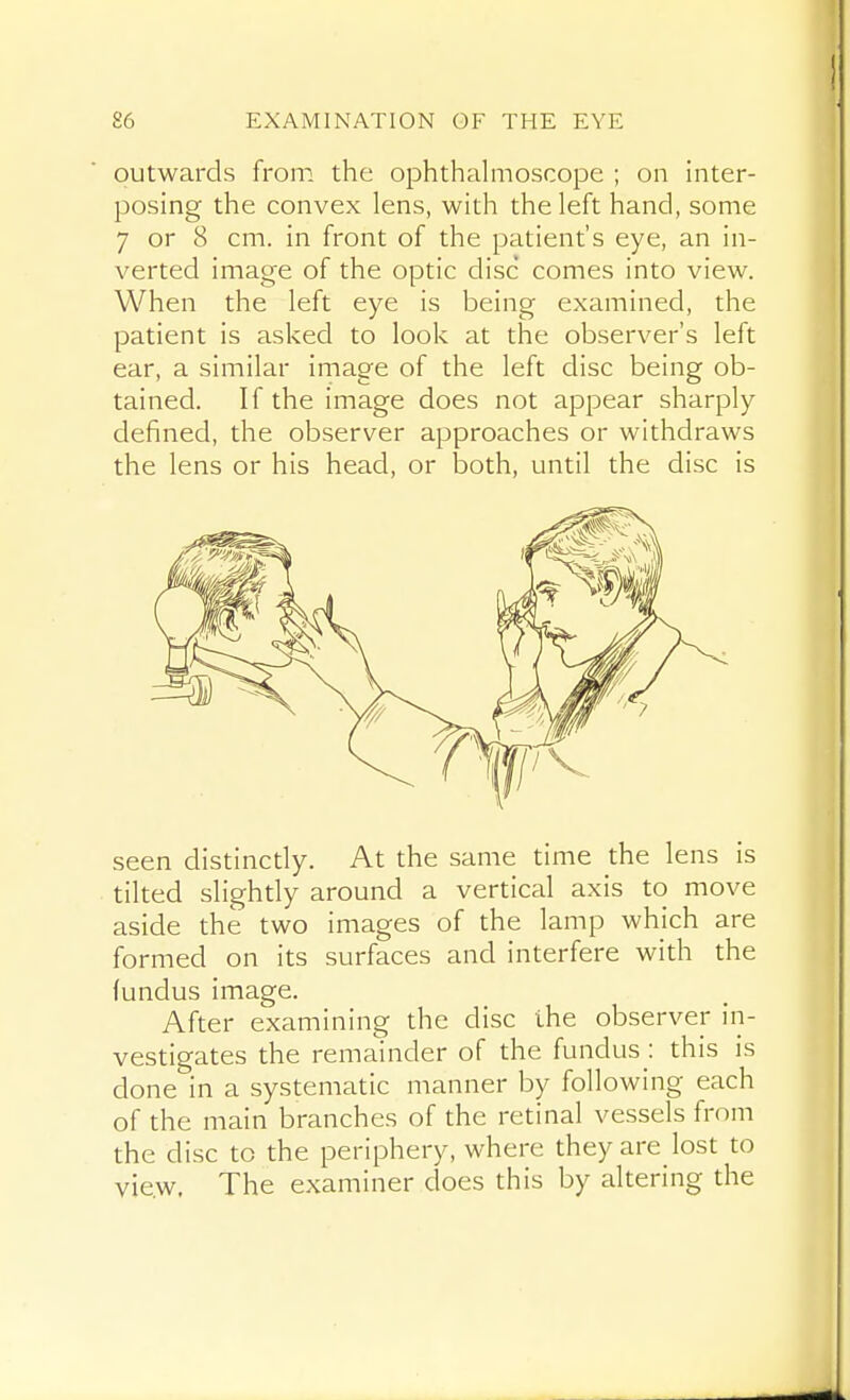 outwards from the ophthalmoscope ; on inter- posing the convex lens, with the left hand, some 7 or 8 cm. in front of the patient's eye, an in- verted image of the optic disc comes into view. When the left eye is being examined, the patient is asked to look at the observer's left ear, a similar image of the left disc being ob- tained. If the image does not appear sharply defined, the observer approaches or withdraws the lens or his head, or both, until the disc is seen distincdy. At the same time the lens is tilted slighdy around a vertical axis to move aside the two images of the lamp which are formed on its surfaces and interfere with the fundus image. After examining the disc the observer in- vestigates the remainder of the fundus : this is done in a systematic manner by following each of the main branches of the retinal vessels from the disc to the periphery, where they are lost to vie.w. The examiner does this by altering the