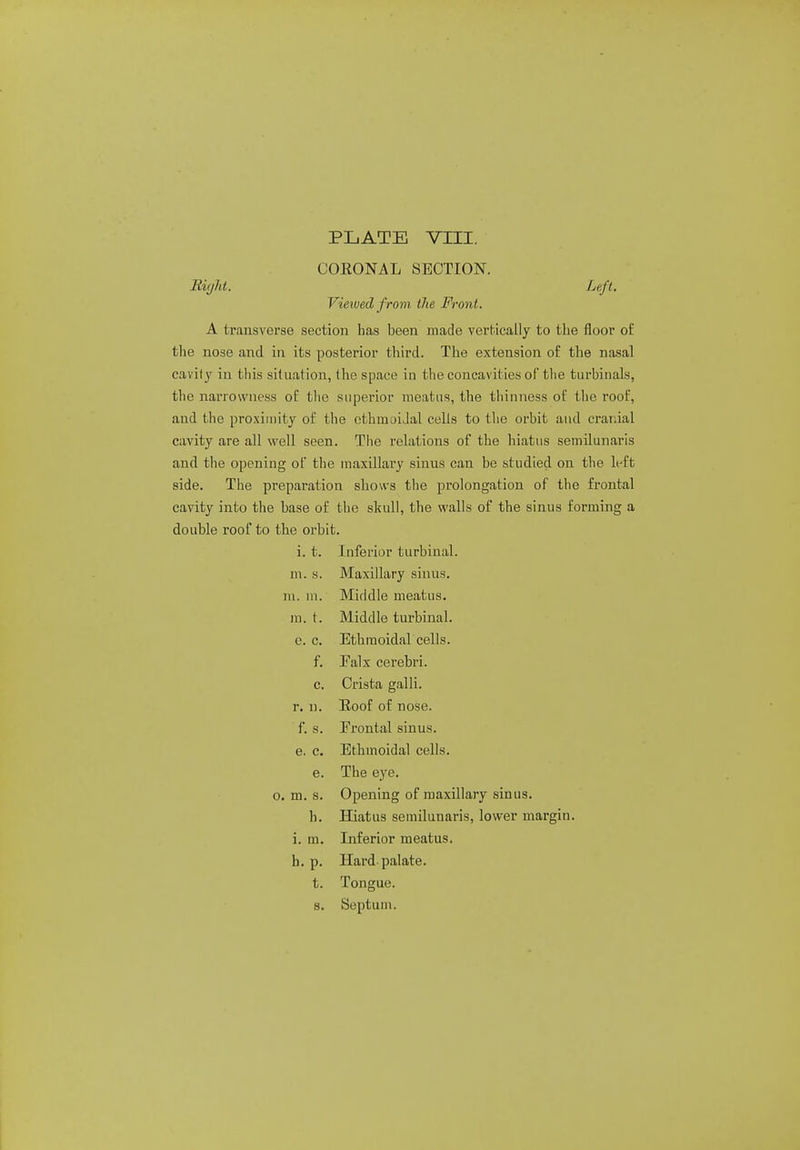 CORONAL SECTION. Riijlit. Left. Viewed f rom the Front. A transverse section has been made vertically to the floor of the nose and in its posterior third. The extension of the nasal cavity in this situation, the space in the concavities of the turbinate, the narrowness of the superior meatus, the thinness of the roof, and the proximity of the ethmoidal cells to the orbit and cranial cavity are all well seen. The relations of the hiatus semilunaris and the opening of the maxillary sinus can be studied on the left side. The preparation shows the prolongation of the frontal cavity into the base of the skull, the walls of the sinus forming a double roof to the orbit. i. t. Inferior turbinal. m. s. Maxillary sinus, ni. m. Middle meatus, m. t. Middle turbinal. c. c. Ethmoidal cells, f. Ealx cerebri, c. Crista galli. r. n. Roof of nose, f. s. Frontal sinus, e. c. Ethmoidal cells, e. The eye. o. m. s. Opening of maxillary sinus. b. Hiatus semilunaris, lower margin, i. m. Inferior meatus, h. p. Hard-palate, t. Tongue, s. Septum.