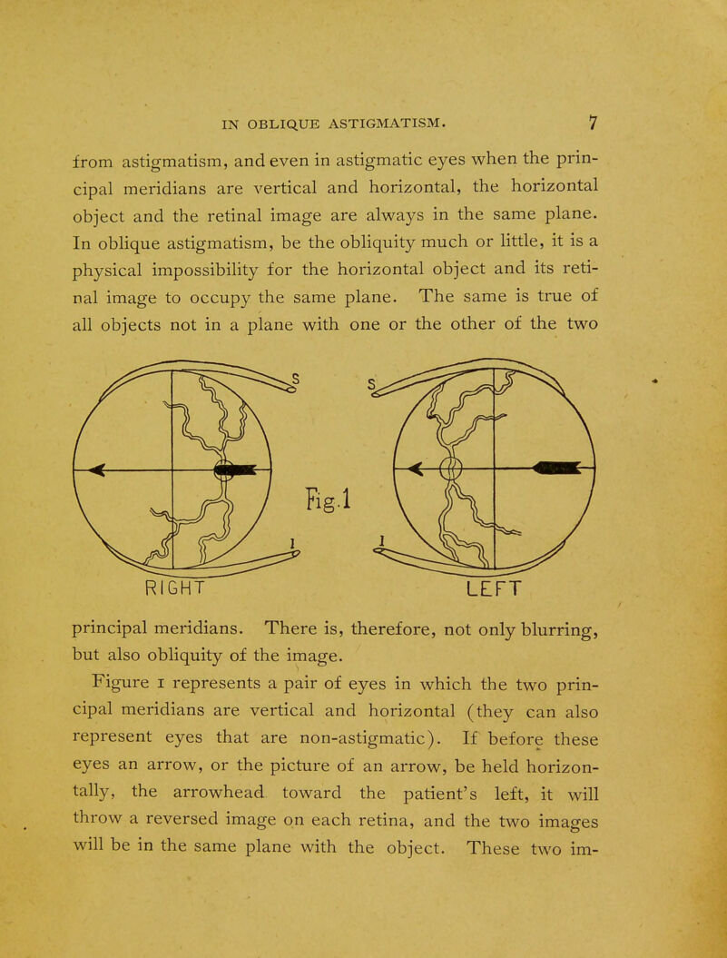 from astigmatism, and even in astigmatic eyes when the prin- cipal meridians are vertical and horizontal, the horizontal object and the retinal image are always in the same plane. In oblique astigmatism, be the obliquity much or little, it is a physical impossibility for the horizontal object and its reti- nal image to occupy the same plane. The same is true of all objects not in a plane with one or the other of the two RIGHT LEFT principal meridians. There is, therefore, not only blurring, but also obliquity of the image. Figure i represents a pair of eyes in which the two prin- cipal meridians are vertical and horizontal (they can also represent eyes that are non-astigmatic). If before these eyes an arrow, or the picture of an arrow, be held horizon- tally, the arrowhead toward the patient's left, it will throw a reversed image on each retina, and the two images will be in the same plane with the object. These two im-