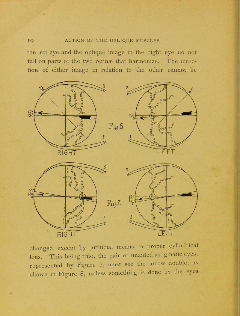 the left eye and the oblique image in the right eye do not fall on parts of the two retinas that harmonize. The direc- tion of either image in relation to the other cannot be RIGHT LETT changed except by artificial means—a proper cylindrical lens. This being true, the pair of unaided astigmatic eyes, represented by Figure 2, must see the arrow double, as shown in Figure 8, unless something is done by the eyes