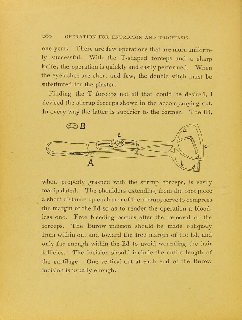 one year. There are few operations that are more uniform- ly successful. With the T-shaped forceps and a sharp knife, the operation is quickly and easily performed. When the eyelashes are short and few, the double stitch must be substituted for the plaster. Finding the T forceps not all that could be desired, I devised the stirrup forceps shown in the accompanying cut. In every way the latter is superior to the former. The lid, when properly grasped with the stirrup forceps, is easily manipulated. The shoulders extending from the foot piece a short distance up each arm of the stirrup, serve to compress the margin of the lid so as to render the operation a blood- less one. Free bleeding occurs after the removal of the forceps. The Burow incision should be made obliquely from within out and toward the free margin of the lid, and only far enough within the lid to avoid wounding the hair follicles. The incision should include the entire length of the cartilage. One vertical cut at each end of the Burow incision is usually enough.