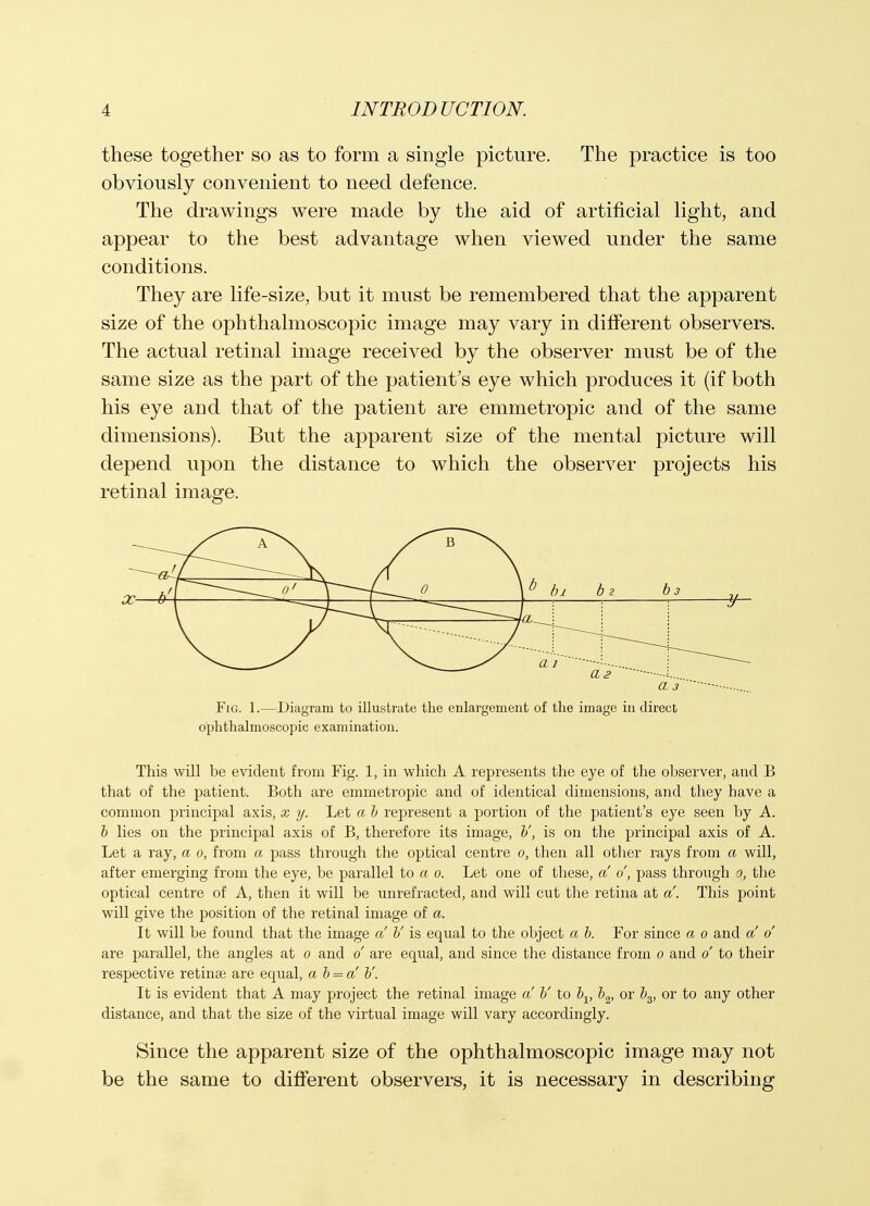 these together so as to form a single picture. The practice is too obviously convenient to need defence. The di'awings were made by the aid of artificial light, and appear to the best advantage when viewed under the same conditions. They are life-size, but it must be remembered that the apparent size of the ophthalmoscopic image may vary in different observers. The actual retinal image received by the observer must be of the same size as the part of the patient's eye which produces it (if both his eye and that of the patient are emmetropic and of the same dimensions). But the apparent size of the mental picture will depend upon the distance to which the observer projects his retinal image. This will be evident from Fig. 1, in which A represents the eye of the observer, and B that of the patient. Both are emmetropic and of identical dimensions, and they have a common principal axis, x y. Let a h rej)resent a portion of the patient's eye seen by A. h lies on the principal axis of B, therefore its image, h', is on the principal axis of A. Let a ray, a o, from a pass through the optical centre o, then all other rays from a will, after emerging from the eye, be parallel to a o. Let one of these, a' o', pass through o, the optical centre of A, then it will be unrefracted, and will cut the retina at a. This point will give the position of the retinal image of a. It will be found that the image a V is equal to the object a h. For since a o and a o are parallel, the angles at o and o are equal, and since the distance from o and o to their respective retinae are equal, a h = a' b'. It is evident that A may project the retinal image a h' to \, b^, or b^, or to any other distance, and that the size of the virtual image will vary accordingly. Since the apparent size of the ophthalmoscopic image may not be the same to different observers, it is necessary in describing Fig. 1.—Diagram to illustrate the enlargement of the image in direct ophthalmoscopic examination.