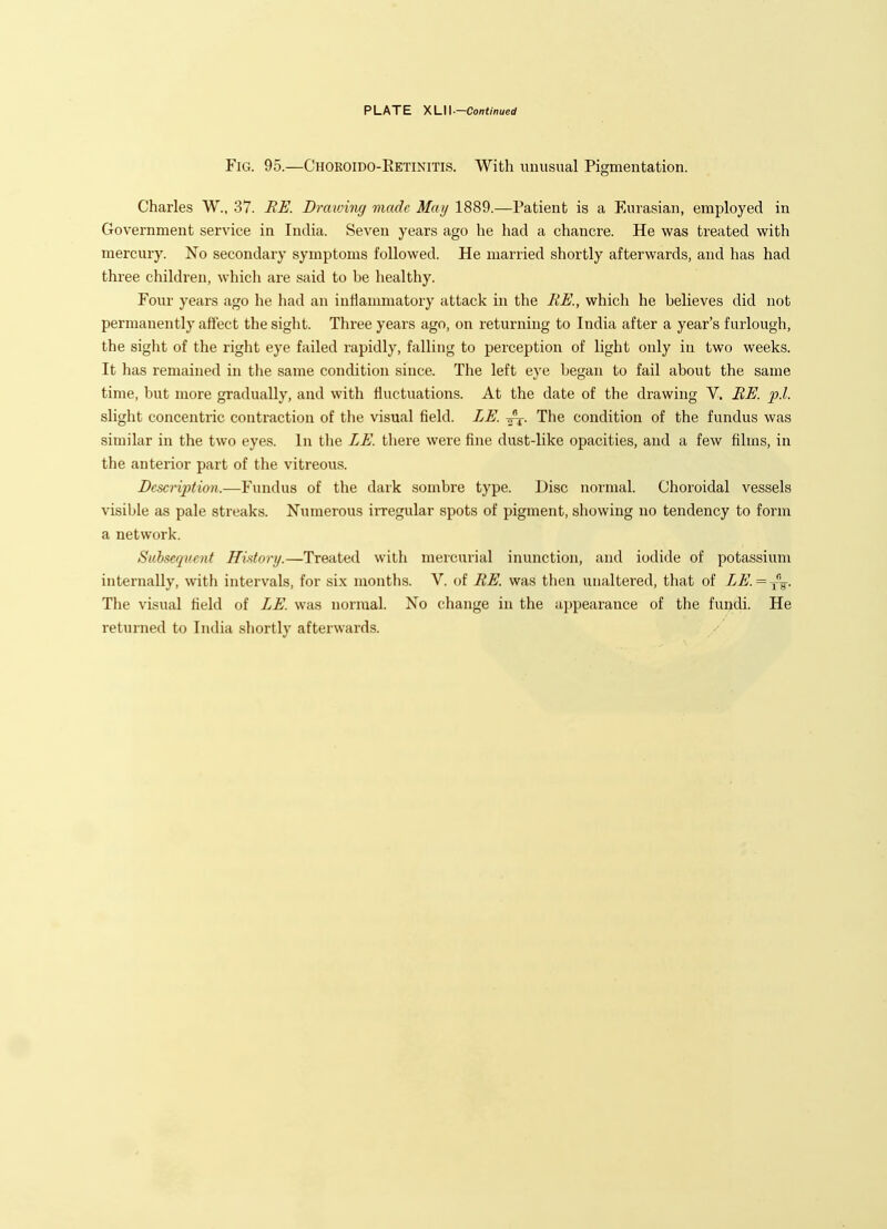 Fig. 95.—Choroido-Eetinitis. With unusual Pigmentation. Charles W., 37. BE. Draiving made May 1889.—Patient is a Eurasian, employed in Government service in India. Seven years ago he had a chancre. He was treated with mercury. No secondary symptoms followed. He married shortly afterwards, and has had three children, which are said to be healthy. Four years ago he had an inliammatory attack in the RE., which he believes did not permanently affect the sight. Three years ago, on returning to India after a year's furlough, the sight of the right eye failed rapidly, falling to perception of light only in two weeks. It has remained in the same condition since. The left eye began to fail about the same time, but more gradually, and with fluctuations. At the date of the drawing V. BE. p.l. slight concentric contraction of the visual field. ZE. The condition of the fundus was similar in the two eyes. In the LE. there were fine dust-like opacities, and a few films, in the anterior part of the vitreous. Description.—Fundus of the dark sombre type. Disc normal. Choroidal vessels visible as pale streaks. Numerous irregular spots of pigment, showing no tendency to form a network. Subsequent History.—Treated with mercurial inunction, and iodide of potassium internally, with intervals, for six months. V. of BE. was then unaltered, that of LE. = The visual field of LE. was normal. No change in the appearance of the fundi. He returned to India shortly afterwards.