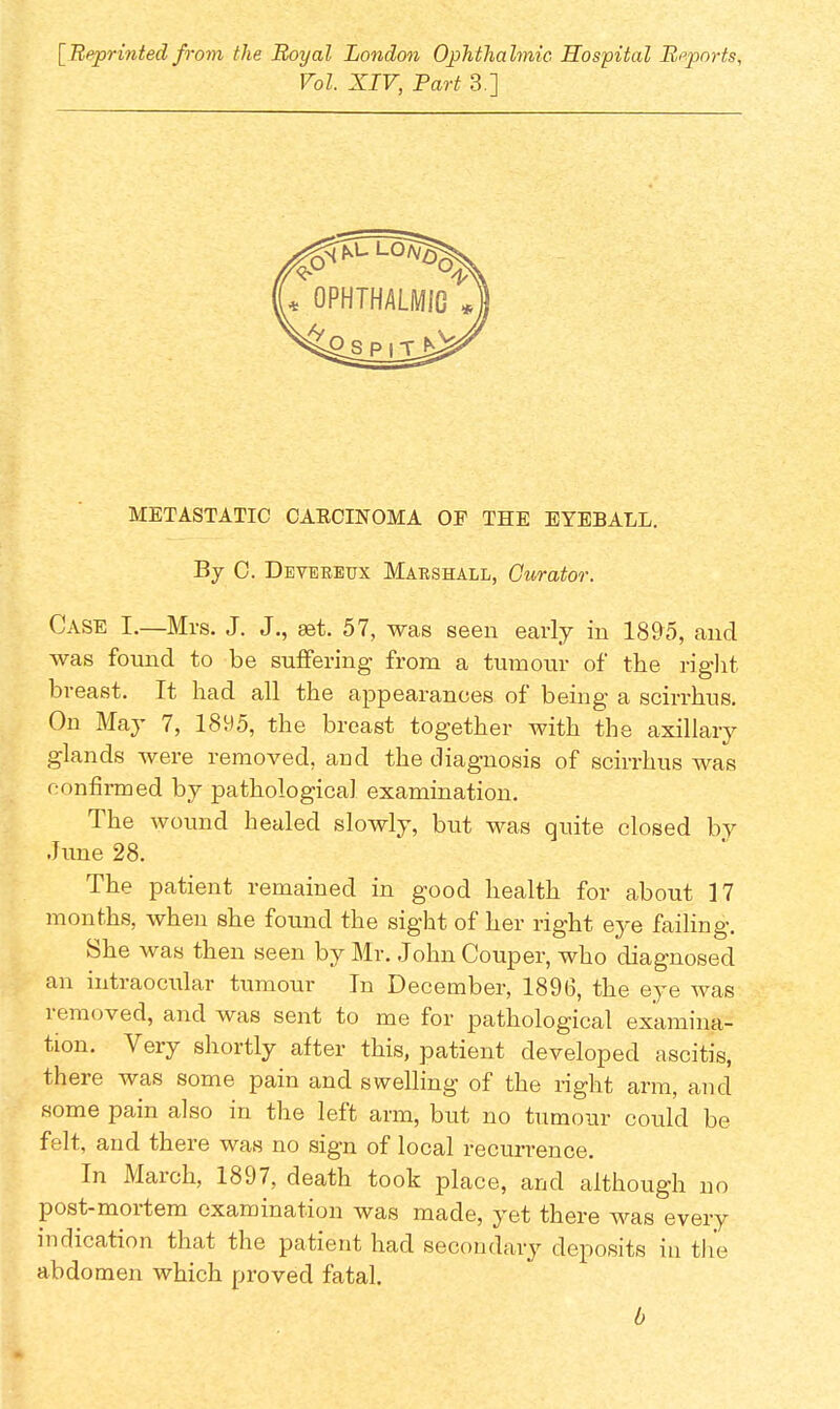 [Reprinted from the Boyal London Ophthalmic, Hospital Reports, Vol. XIV, Part 3.] METASTATIC CAKCINOMA OF THE EYEBALL. By 0. Deverbux Marshall, Curator. Case I.—Mrs. J. J., set. 57, was seen early in 1895, and was found to be suffering from a tumour of the right breast. It had all the appearances of being a scirrhus. On May 7, 1895, the breast together with the axillary glands were removed, and the diagnosis of scirrhus was confirmed by pathological examination. The wound healed slowly, but was quite closed by June 28. The patient remained in good health for about 17 months, when she found the sight of her right eye failing. She was then seen by Mr. John Couper, who diagnosed an intraocular tumour In December, 189(3, the eye was removed, and was sent to me for pathological examina- tion. Very shortly after this, patient developed ascitis, there was some pain and swelling of the right arm, and some pain also in the left arm, but no tumour could be felt, and there was no sign of local recurrence. In March, 1897, death took place, and although no post-mortem examination was made, yet there was every indication that the patient had secondary deposits in the abdomen which proved fatal. 0