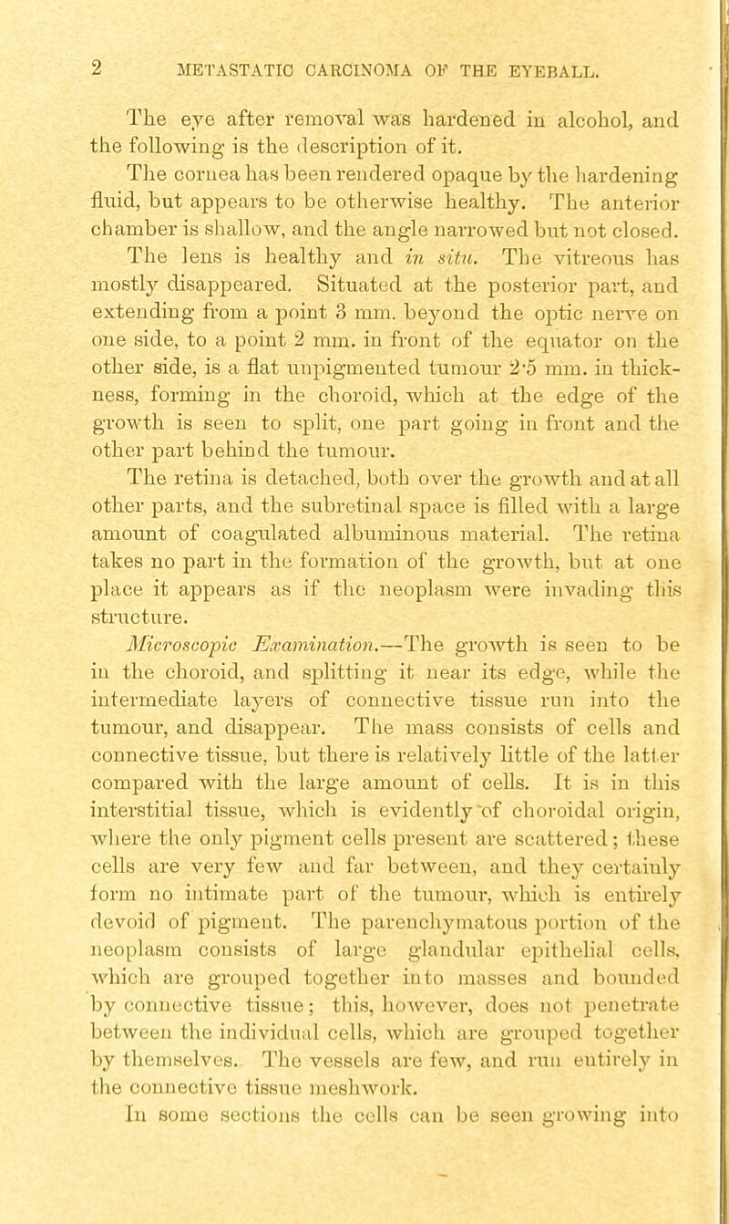 The eye after removal was hardened in alcohol, and the following is the description of it. The cornea has been rendered opaque by the hardening fluid, but appears to be otherwise healthy. The anterior chamber is shallow, and the angle narrowed but not closed. The lens is healthy and in situ. The vitreous has mostly disappeared. Situated at the posterior part, and extending from a point 3 mm. beyond the optic nerve on one side, to a point 2 mm. in front of the equator on the other side, is a flat unpigmented tumour 2*5 mm. in thick- ness, forming in the choroid, which at the edge of the growth is seen to split, one part going in front and the other part behind the tumour. The retina is detached, both over the growth and at all other parts, and the subretinal space is filled with a large amount of coagulated albuminous material. The retina takes no part in the formation of the growth, but at one place it appears as if the neoplasm were invading this structure. Microscopic Examination.—The growth is seen to be in the choroid, and splitting it near its edge, while the intermediate layers of connective tissue run into the tumour, and disappear. The mass consists of cells and connective tissue, but there is relatively little of the latter compared with the large amount of cells. It is in this interstitial tissue, which is evidently of choroidal origin, where the only pigment cells present are scattered; these cells are very few and far between, and they certainly form no intimate part of the tumour, which is entirely devoid of pigment. The parenchymatous portion of the neoplasm consists of large glandular epithelial cells, which are grouped together into masses and bounded by connective tissue; this, however, does not penetrate between the individual cells, which are grouped together by themselves. The vessels are few, and run eutirely in the connective tissue meshwork. In some sections the cells can be seen growing into