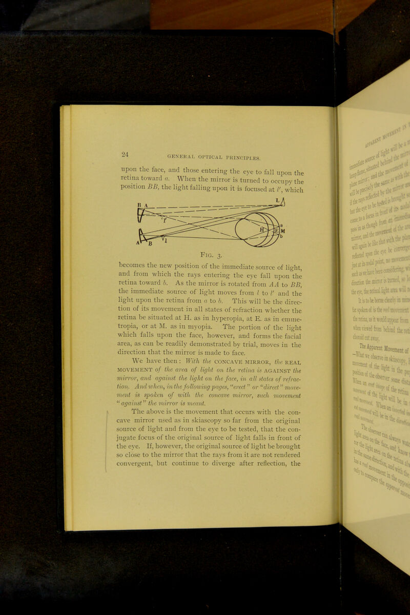 GENERAL Ol'TiCAL rKINCIPLES. upon the face, and those entering the eye to fall upon the retma toward a. When the mirror is turned to occupy the position BB, the light falling upon it is focused at which Fig. 3. becomes the new position of the immediate source of light, and from which the rays entering the eye fall upon the retina toward b. As the mirror is rotated from A A to BB, moves from I to I' and the light upon the retina from a to b. This will be the direc- tion of its movement in all states of refraction whether the retina be situated at H. as in hyperopia, at E. as in emme- tropia, or at M. as in myopia. The portion of the light which falls upon the face, however, and forms the facial area, as can be readily demonstrated by trial, moves in the direction that the mirror is made to face. We have then : With the concave mirror, tlie reai, MOVEMENT of the area of light on the retina is against the mirror, and against the light on the face, in all states of refrac- tion. And when, in the following pages, erect  or direct move- ment is spoken of with the concave mirror, such movement  against the mirror is meant. The above is the movement that occurs with the con- cave mirror used as in skiascojDy so far from the original source of light and from the eye to be tested, that the con- jugate focus of the original source of light falls in front of the eye. If, however, the original source of light be brought so close to the mirror that the rays from it are not rendered convergent, but continue to diverge after reflection, the t tiie ey^^ of j„sl atfcirf point, no^^^';- idiasweliavebeeiicoiisidennj:^ direction tlie mirror is liinu ' - tlieeye,tlieielir.alliglitaru . It is lok borne clearly in raiiM lat spoken of is the lYolraovement tlie retina, as it would appear bra Aiiviewed from beliiiid theleti ciioroid ciitawav. The Apparent Movement of -W^atwe observe inskia^opvl **''«ftl>e light i„ ?^ position .f.. • *'^'ie- oftlieobsen-prc en an (reof >%i lias pare tile