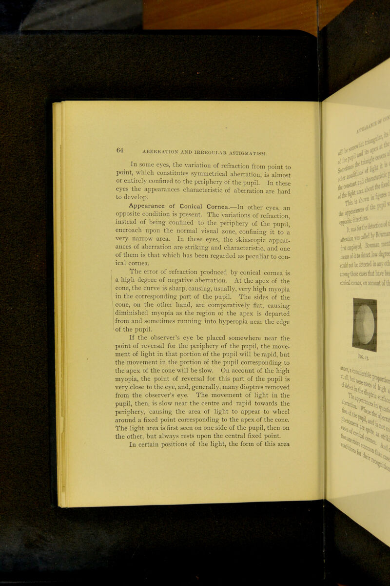 In some eyes, the variation of refraction from point to point, which constitutes symmetrical aberration, is ahnost or entirely confined to the periphery of the pupil. In these eyes the appearances characteristic of aberration are hard to develop. Appearance of Conical Cornea.—In other eyes, an opposite condition is present. The variations of refraction, instead of being confined to the periphery of the pupil, encroach upon the normal visual zone, confining it to a very narrow area. In these eyes, the skiascopic appear- ances of aberration are striking and characteristic, and one of them is that which has been regarded as peculiar to con- ical cornea. The error of refraction produced by conical cornea is a high degree of negative aberration. At the apex of the cone, the curve is sharp, causing, usually, very high myopia in the corresponding part of the pupil. The sides of the \ cone, on the other hand, are comparatively flat, causing I diminished myopia as the region of the apex is departed I from and sometimes running into hyperopia near the edge I of the pupil. If the observer's eye be placed somewhere near the point of reversal for the periphery of the pupil, the move- ment of light in that portion of the pupil will be rapid, but the movement in the portion of the pupil corresponding to the apex of the cone will be slow. On account of the high myopia, the point of reversal for this part of the pupil is very close to the eye, and, generally, many dioptres removed from the observer's eye. The movement of light in the pupil, then, is slow near the centre and rapid towards the periphery, causing the area of light to appear to wheel around a fixed point corresponding to the apex of the cone. The light area is first seen on one side of the pupil, then on the other, but always rests upon the central fixed point. In certain positions of the light, the form of this area