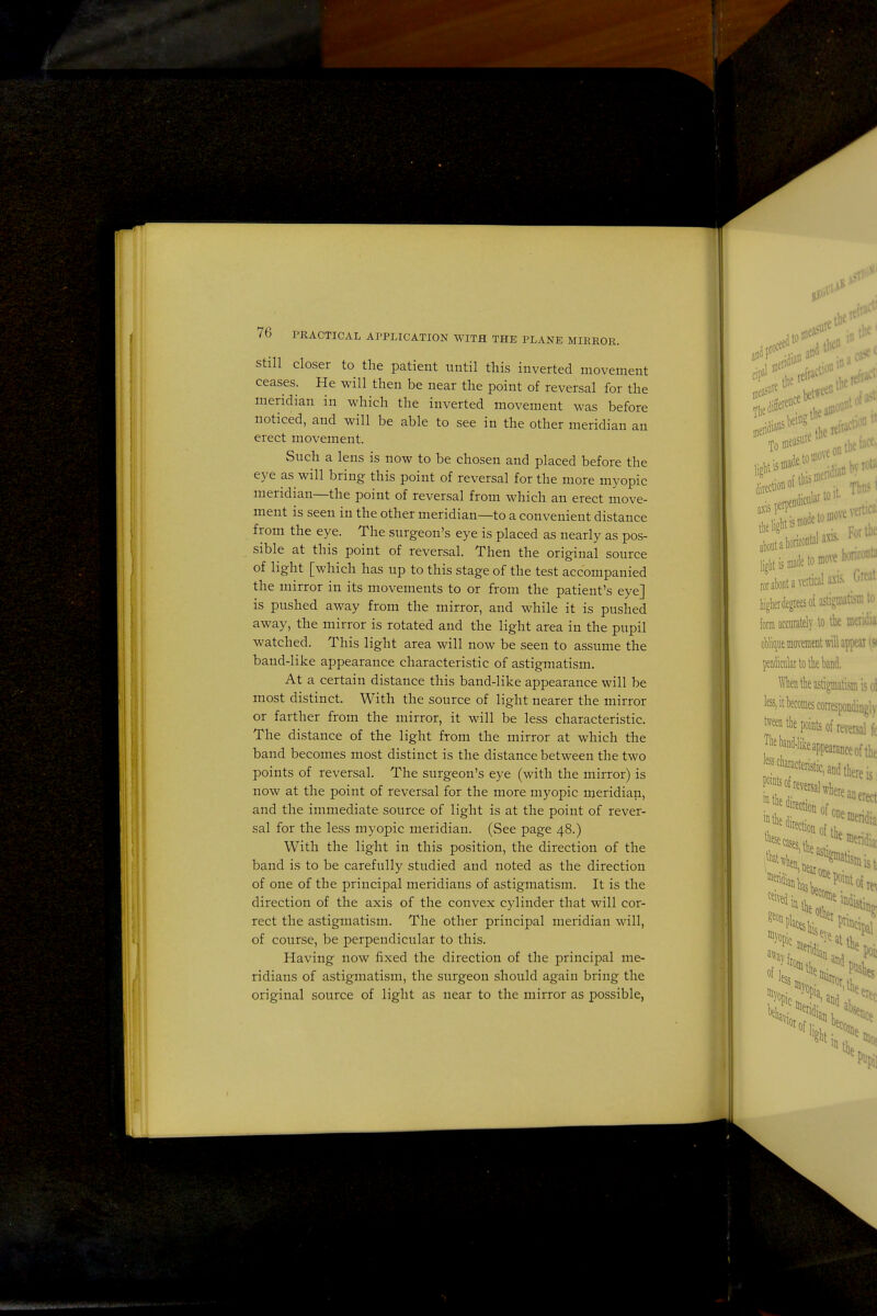 Still closer to the patient until this inverted movement ceases. He will then be near the point of reversal for the meridian in which the inverted movement was before noticed, and will be able to see in the other meridian an erect movement. Such a lens is now to be chosen and placed before the eye as will bring this point of reversal for the more myopic meridian—the point of reversal from which an erect move- ment is seen in the other meridian—to a convenient distance from the eye. The surgeon's eye is placed as nearly as pos- sible at this point of reversal. Then the original source of light [which has up to this stage of the test accompanied the mirror in its movements to or from the patient's eye] is pushed away from the mirror, and while it is pushed away, the mirror is rotated and the light area in the pupil watched. This light area will now be seen to assume the band-like appearance characteristic of astigmatism. At a certain distance this band-like appearance will be most distinct. With the source of light nearer the mirror or farther from the mirror, it will be less characteristic. The distance of the light from the mirror at which the band becomes most distinct is the distance between the two points of reversal. The surgeon's eye (with the mirror) is now at the point of reversal for the more myopic meridian, and the immediate source of light is at the point of rever- sal for the less myopic meridian. (See page 48.) With the light in this position, the direction of the band is to be carefully studied and noted as the direction of one of the principal meridians of astigmatism. It is the direction of the axis of the convex cylinder that will cor- rect the astigmatism. The other principal meridian will, of course, be perpendicular to this. Having now fixed the direction of the principal me- ridians of astigmatism, the surgeon should again bring the original source of light as near to the mirror as possible,