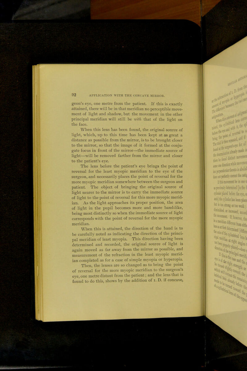 geon's eye, one metre from the patient. If this is exactly- attained, there will be in that meridian no perceptible move- ment of light and shadow, but the movement in the other principal meridian will still be with that of the light on the face. When this lens has been found, the original source of light, which, up to this time has been kept at as great a distance as possible from the mirror, is to be brought closer to the mirror, so that the image of it formed at the conju- gate focus in front of the mirror—the immediate source of light—will be removed farther from the mirror and closer to the patient's eye. The lens before the patient's eye brings the point of reversal for the least myopic meridian to the eye of the surgeon, and necessarily places the point of reversal for the more myopic meridian somewhere between the surgeon and patient. The object of bringing the original source of light nearer to the mirror is to carry the immediate source of light to the point of reversal for this more myopic merid- ian. As the light approaches its proper position, the area of light in the pupil becomes more and more band-like, being most distinctly so when the immediate source of light corresponds with the point of reversal for the rrwre myopic meridian. When this is attained, the direction of the band is to be carefully noted as indicating the direction of the princi- pal meridian of least myopia. This direction having been determined and recorded, the original source of light is again moved as far away from the mirror as possible, and measurement of the refraction in the least myopic merid- ian completed as for a case of simple myopia or hyperopia. Then, the lenses are so changed as to bring the point of reversal for the more myopic meridian to the surgeon's eye, one metre distant from the patient; and the lens that is found to do this, shows by the addition of i. D. if concave,