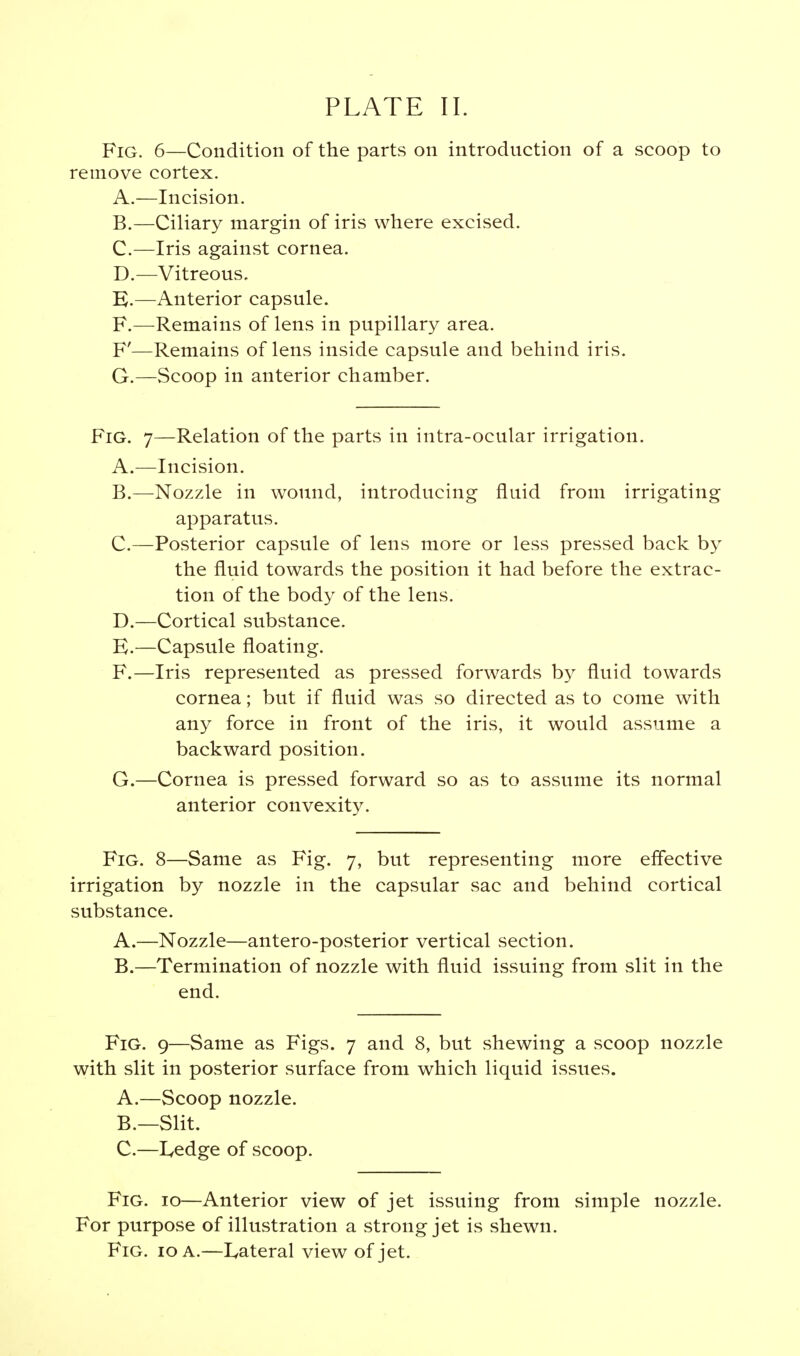 Fig. 6—Condition of the parts on introduction of a scoop to remove cortex. A. —Incision. B. —Ciliary margin of iris where excised. C. —Iris against cornea. D. — Vitreous. E. —Anterior capsule. F. —Remains of lens in pupillary area. F'—Remains of lens inside capsule and behind iris. G. —Scoop in anterior chamber. Fig. 7—Relation of the parts in intra-ocular irrigation. A. —Incision. B. —Nozzle in wound, introducing fluid from irrigating apparatus. C. —Posterior capsule of lens more or less pressed back by the fluid towards the position it had before the extrac- tion of the body of the lens. D. —Cortical substance. E. —Capsule floating. F. —Iris represented as pressed forwards by fluid towards cornea; but if fluid was so directed as to come with any force in front of the iris, it would assume a backward position. G. —Cornea is pressed forward so as to assume its normal anterior convexity. Fig. 8—Same as Fig. 7, but representing more effective irrigation by nozzle in the capsular sac and behind cortical substance. A. —Nozzle—antero-posterior vertical section. B. —Termination of nozzle with fluid issuing from slit in the end. Fig. 9—Same as Figs. 7 and 8, but shewing a scoop nozzle with slit in posterior surface from which liquid issues. A. —Scoop nozzle. B. —Slit. C. —L,edge of scoop. Fig. 10—Anterior view of jet issuing from simple nozzle. For purpose of illustration a strong jet is shewn.
