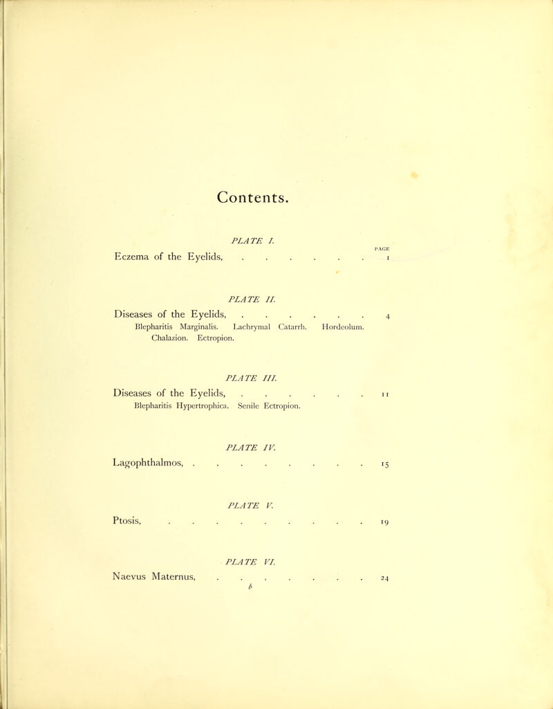 Contents. PLATE I. Eczema of the Eyelids, PAGE Eczema of the Eyelids, ...... i PLATE II. Diseases of the Eyelids, -4 Blepharitis Marginalis. Lachrymal Catarrh. Hordeolum. Chalazion. Ectropion. PLATE III. Diseases of the Eyelids, . . . . . . n Blepharitis Hypertrophica. Senile Ectropion. PLATE IV. Lagophthalmos, . . . . . . . -15 PLATE V. Ptosis, ......... 19 PLATE VI. Naevus Maternus, ....... 24 b