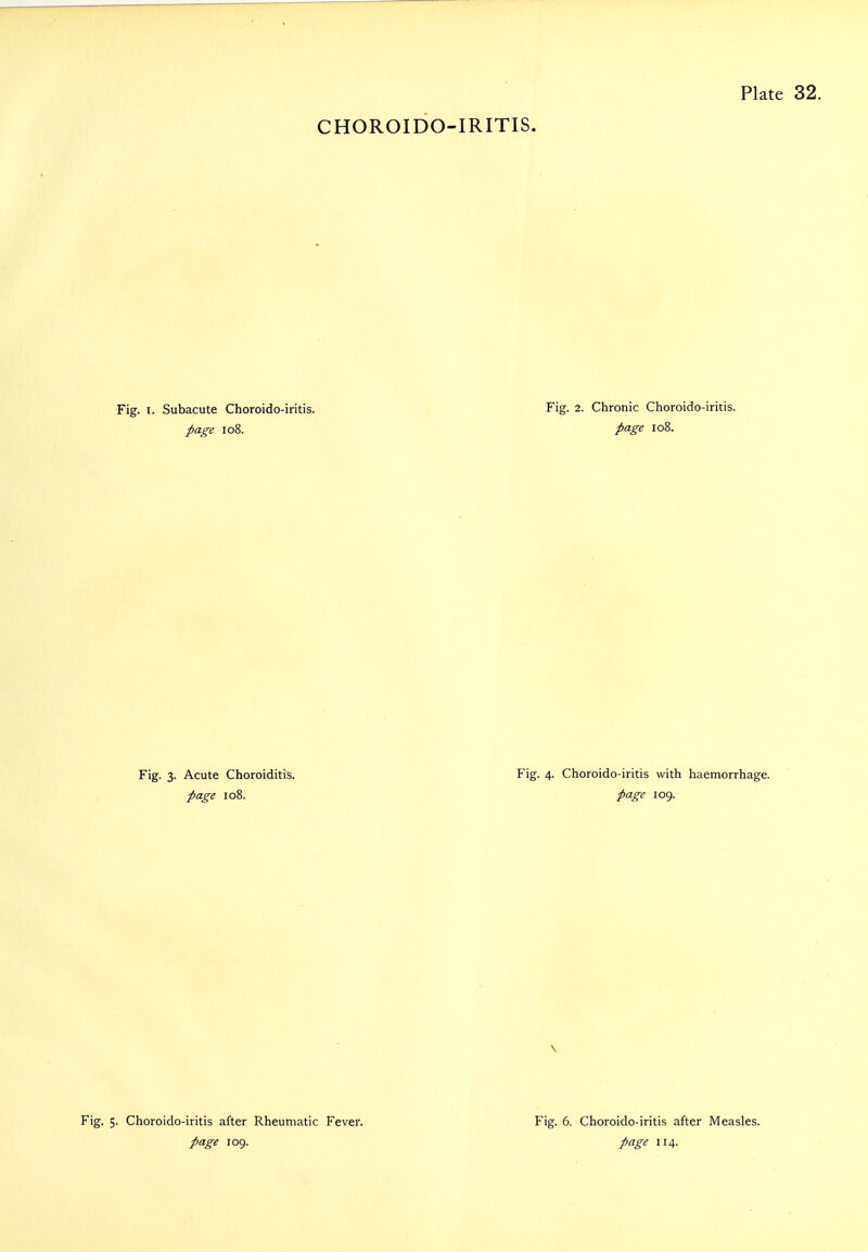 CHOROIDO-IRITIS. Fig. Subacute Choroido-iritis. page 108. Fig. 3. Acute Choroiditis. page 108. Fig. 2. Chronic Choroido-iritis. page 108. Fig. Choroido-iritis with haemorrhage. page 109. Fig. 5. Choroido-iritis after Rheumatic Fever. page 109. Fig. 6. Choroido-iritis after Measles. page 114.