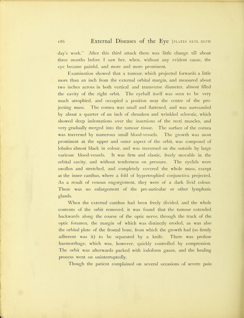day's work. After this third attack there was little change till about three months before I saw her, when, without any evident cause, the eye became painful, and more and more prominent. Examination showed that a tumour, which projected forwards a little more than an inch from the external orbital margin, and measured about two inches across in both vertical and transverse diameter, almost filled the cavity of the right orbit. The eyeball itself was seen to be very much atrophied, and occupied a position near the centre of the pro- jecting mass. The cornea was small and flattened, and was surrounded by about a quarter of an inch of shrunken and wrinkled sclerotic, which showed deep indentations over the insertions of the recti muscles, and very gradually merged into the tumour tissue. The surface of the cornea was traversed by numerous small blood-vessels. The growth was most prominent at the upper and outer aspect of the orbit, was composed of lobules almost black in colour, and was traversed on the outside by large varicose blood-vessels. It was firm and elastic, freely movable in the orbital cavity, and without tenderness on pressure. The eyelids were swollen and stretched, and completely covered the whole mass, except at the inner canthus, where a fold of hypertrophied conjunctiva projected. As a result of venous engorgement, they were of a dark livid colour. There was no enlargement of the pre-auricular or other lymphatic glands. When the external canthus had been freely divided, and the whole contents of the orbit removed, it was found that the tumour extended backwards along the course of the optic nerve, through the track of the optic foramen, the margin of which was distinctly eroded, as was also the orbital plate of the frontal bone, from which the growth had (so firmly adherent was it) to be separated by a knife. There was profuse haemorrhage, which was, however, quickly controlled by compression. The orbit was afterwards packed with iodoform gauze, and the healing process went on uninterruptedly. Though the patient complained on several occasions of severe pain