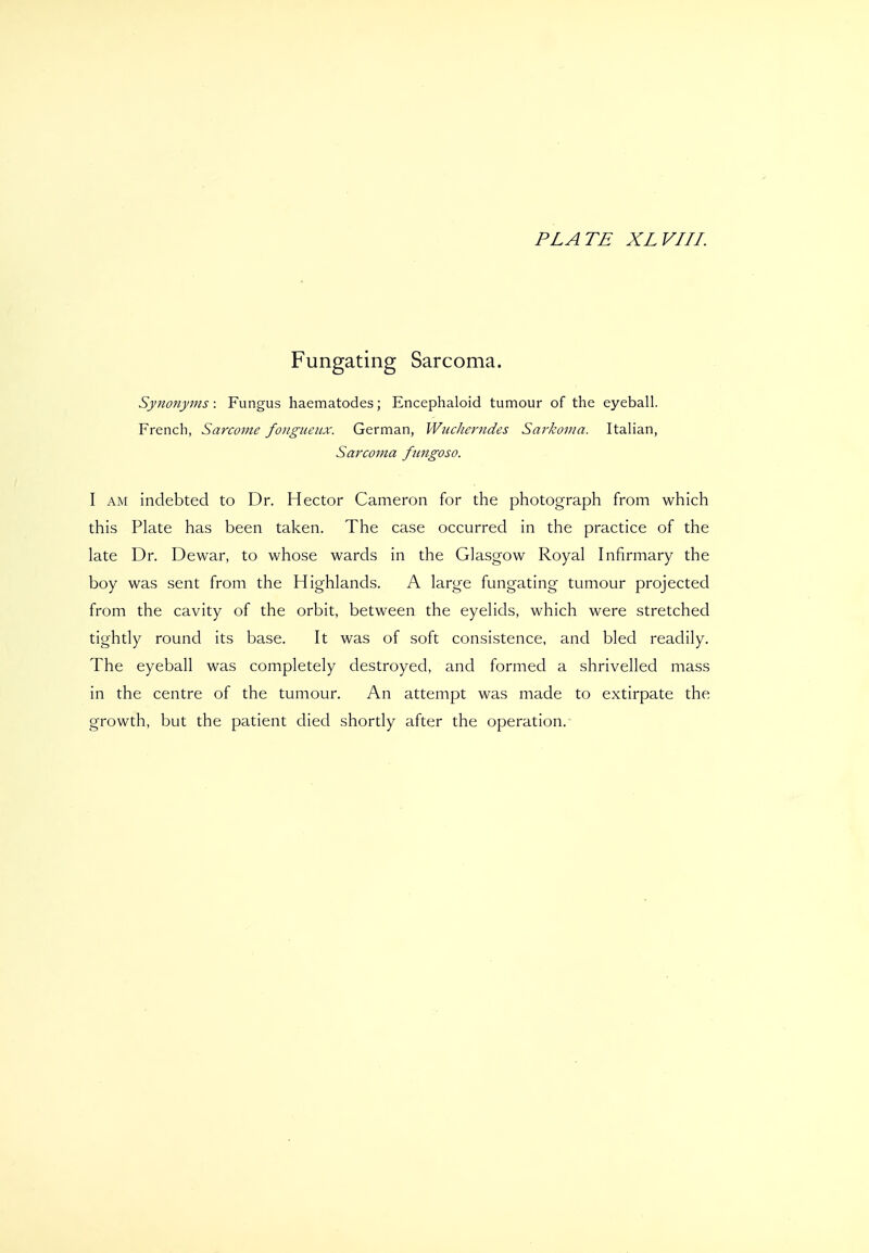 Fungating Sarcoma. Synonyms: Fungus haematodes; Encephaloid tumour of the eyeball. French, Sarcome foiigueiix. German, Wucherndes Sarkoma. Italian, Sarcoma fungoso. I AM indebted to Dr. Hector Cameron for the photograph from which this Plate has been taken. The case occurred in the practice of the late Dr. Dewar, to whose wards in the Glasgow Royal Infirmary the boy was sent from the Highlands. A large fungating tumour projected from the cavity of the orbit, between the eyelids, which were stretched tightly round its base. It was of soft consistence, and bled readily. The eyeball was completely destroyed, and formed a shrivelled mass in the centre of the tumour. An attempt was made to extirpate the growth, but the patient died shortly after the operation.