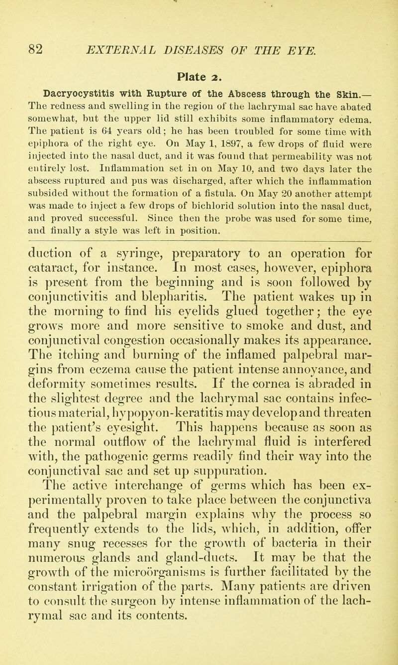 Plate 2. Dacryocystitis with Rupture of the Abscess through the Skin.— The redness and swelling in the region of the lachrymal sac have abated somewhat, but the upper lid still exhibits some inflammatory edema. The patient is 64 years old; he has been troubled for some time with epiphora of the right eye. On May 1, 1897, a few drops of fluid were injected into the nasal duct, and it was found that permeability was not entirely lost. Inflammation set in on May 10, and two days later the abscess ruptured and pus was discharged, after which the inflammation subsided without the formation of a fistula. On May 20 another attempt was made to inject a few drops of bichlorid solution into the nasal duct, and proved successful. Since then the probe was used for some time, and finally a style was left in position. duction of a syringe, preparatory to an operation for cataract, for instance. In most cases, however, epiphora is present from the beginning and is soon followed by conjunctivitis and blepharitis. The patient wakes up in the morning to find his eyelids glued together; the eye grows more and more sensitive to smoke and dust, and conjunctival congestion occasionally makes its appearance. The itching and burning of the inflamed palpebral mar- gins from eczema cause the patient intense annoyance, and deformity sometimes results. If the cornea is abraded in the slightest degree and the lachrymal sac contains infec- tious material, hypopyon-keratitis may develop and threaten the patient's eyesight. This happens because as soon as the normal outflow of the lachrymal fluid is interfered with, the pathogenic germs readily find their way into the conjunctival sac and set up suppuration. The active interchange of germs which has been ex- perimentally proven to take place between the conjunctiva and the palpebral margin explains why the process so frequently extends to the lids, which, in addition, offer many snug recesses for the growth of bacteria in their numerous glands and gland-ducts. It may be that the growth of the microorganisms is further facilitated by the constant irrigation of the parts. Many patients are driven to consult the surgeon by intense inflammation of the lach- rymal sac and its contents.