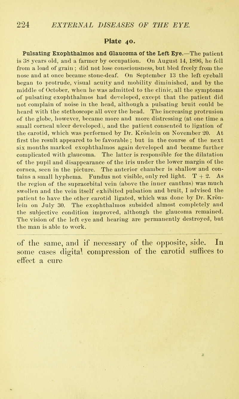 Plate 40. Pulsating Exophthalmos and Glaucoma of the Left Eye.—The patient is 38 years old, and a farmer by occupation. On August 14, 1896, he fell from a load of grain ; did not lose consciousness, but bled freely from the nose and at once became stone-deaf. On September 13 the left eyeball began to protrude, visual acuity and mobility diminished, and by the middle of October, when he was admitted to the clinic, all the symptoms of pulsating exophthalmos had developed, except that the patient did not complain of noise in the head, although a pulsating bruit could be heard with the stethoscope all over the head. The increasing protrusion of the globe, however, became more and more distressing (at one time a small corneal ulcer developed), and the patient consented to ligation of the carotid, which was performed by Dr. Kronlein on November 20. At first the result appeared to be favorable ; but in the course of the next six months marked exophthalmos again developed and became further complicated with glaucoma. The latter is responsible for the dilatation of the pupil and disappearance of the iris under the lower margin of the cornea, seen in the picture. The anterior chamber is shallow and con- tains a small hyphema. Fundus not visible, only red light. T + 2. As the region of the supraorbital vein (above the inner can thus) was much swollen and the vein itself exhibited pulsation and bruit, I advised the patient to have the other carotid ligated, which was done by Dr. Kron- lein on July 30. The exophthalmos subsided almost completely and the subjective condition improved, although the glaucoma remained. The vision of the left eye and hearing are permanently destroyed, but the man is able to work. of the same, and if necessary of the opposite, side. In some cases digital compression of the carotid suffices to effect a cure