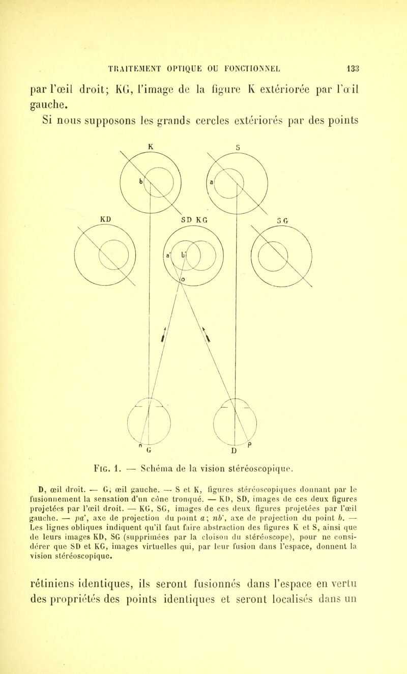 par l'œil droit; KG, l'image de la figure K extériorée par Toril gauche. Si nous supposons les grands cercles extériorés par des points FlG. 1. — Schéma de la vision stéréoscopique. D, œil droit. — G, œil gauche. — S et K, figures stéréoscopiques donnant par le fusionnement la sensation d'un cône tronqué. — Kl), SD, images de ces deux figures projetées par l'œil droit. — KG, SG, images de ces deux figures projetées par l'œil gauche. — pa\ axe de projection du point a; nb\ axe de projection du point b. — Les lignes obliques indiquent qu'il faut faire abstraction des figures K et S, ainsi que de leurs images KD, SG (supprimées par la cloison du stéréoscope), pour ne consi- dérer que SD et KG, images virtuelles qui, par leur fusion dans l'espace, donnent la vision stéréoscopique. rétiniens identiques, ils seront fusionnés dans l'espace en vertu des propriétés des points identiques et seront localisés dans un