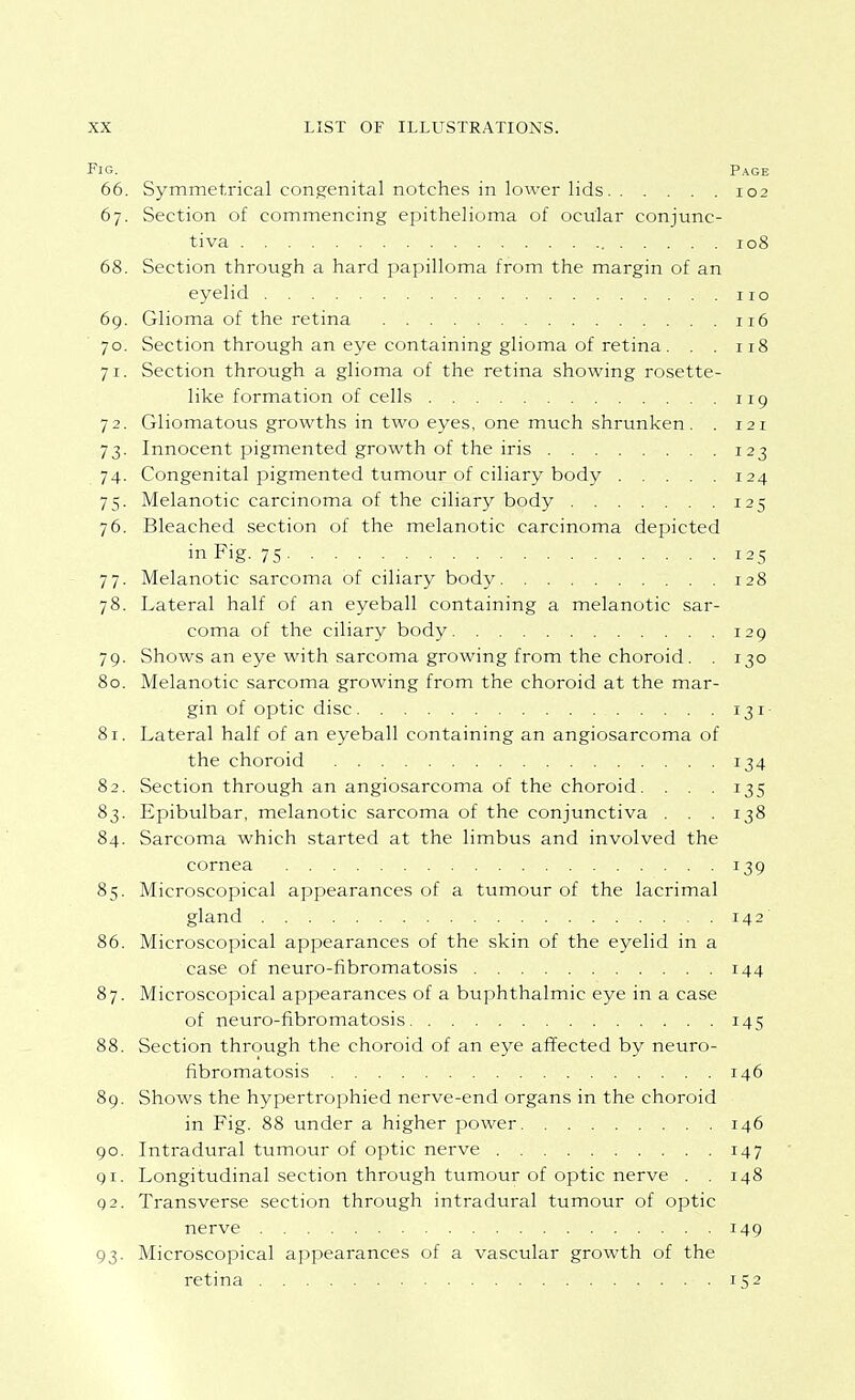 Fig. Page 66. Symmetrical congenital notches in lower lids 102 67. Section of commencing epithelioma of ocular conjunc- tiva 108 68. Section through a hard papilloma from the margin of an eyelid no 69. Glioma of the retina 116 70. Section through an eye containing glioma of retina. . .118 71. Section through a glioma of the retina showing rosette- like formation of cells 119 72. Gliomatous growths in two eyes, one much shrunken. . 121 73. Innocent pigmented growth of the iris 123 74. Congenital pigmented tumour of ciliary body 124 75. Melanotic carcinoma of the ciliary body 125 76. Bleached section of the melanotic carcinoma depicted in Fig. 75 125 77. Melanotic sarcoma of ciliary body 128 78. Lateral half of an eyeball containing a melanotic sar- coma of the ciliary body 129 79. Shows an eye with sarcoma growing from the choroid. . 130 80. Melanotic sarcoma growing from the choroid at the mar- gin of optic disc 131- 81. Lateral half of an eyeball containing an angiosarcoma of the choroid 134 82. Section through an angiosarcoma of the choroid. ... 135 83. Epibulbar, melanotic sarcoma of the conjunctiva . . . 138 84. Sarcoma which started at the limbus and involved the cornea 139 85. Microscopical appearances of a tumour of the lacrimal gland 142 86. Microscopical appearances of the skin of the eyelid in a case of neuro-fibromatosis 144 87. Microscopical appearances of a buphthalmic eye in a case of neuro-fibromatosis 145 88. Section through the choroid of an eye affected by neuro- fibromatosis 146 89. Shows the hypertrophied nerve-end organs in the choroid in Fig. 88 under a higher power 146 90. Intradural tumour of optic nerve 147 91. Longitudinal section through tumour of optic nerve . .148 Q2. Transverse section through intradural tumour of optic nerve 149 93. Microscopical appearances of a vascular growth of the retina 152