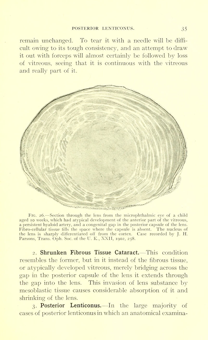 remain unchanged. To tear it with a needle wiU be diffi- cult owing to its tough consistency, and an attempt to draw it out with forceps will almost certainly be followed by loss of vitreous, seeing that it is continuous with the vitreous and really part of it. Fig. 26.—Section through the lens from the microphthahiiic eye of a child aged 10 weeks, which had at}-pical development of the anterior part of the vitreous, a persistent hyaloid artery, and a congenital gap in the posterior capsule of the lens. Fibro-cellular tissue fills the space where the capsule is absent. The nucleus of the lens is sharply differentiated olf from the cortex. Case recorded by J. H. Parsons, Trans. Oph. Soc. of the U. K., XXII, 1902, 258. 2. Shrunken Fibrous Tissue Cataract.—This condition resembles the former, but in it instead of the fibrous tissue, or atypically developed vitreous, merely bridging across the gap in the posterior capsule of the lens it extends through the gap into the lens. This invasion of lens substance by mesoblastic tissue causes considerable absorption of it and shrinking of the lens. 3. Posterior Lenticonus.—In the large majority of cases of posterior lenticonus in which an anatomical examina-