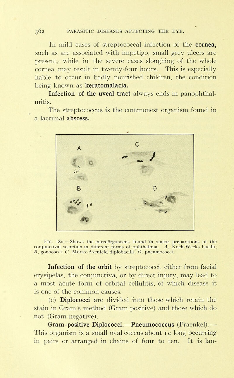 In mild cases of streptococcal infection of the cornea, such as are associated with impetigo, small grey ulcers are present, while in the severe cases sloughing of the whole cornea may result in twenty-four hours. This is especially liable to occur in badly nourished children, the condition being known as keratomalacia. Infection of the uveal tract always ends in panophthal- mitis. The streptococcus is the commonest organism found in a lacrimal abscess. A c /I' B D Fig. 180.—Shows the microorganisms found in smear preparations of the conjunctival secretion in different forms of ophthalmia. A, Koch-Weeks bacilli; B, gonococci; C. Morax-A.xenfeld diplobacilli; D. pneumococci. Infection of the orbit by streptococci, either from facial erysipelas, the conjunctiva, or by direct injury, may lead to a most acute fonn of orbital cellulitis, of which disease it is one of the common causes. (c) Diplococci are divided into those which retain the stain in Gram's method (Gram-positive) and those which do not (Gram-negative). Gram-positive Diplococci.—Pneumococcus (Fraenkel).— This organism is a small oval coccus about i n long occurring in pairs or arranged in chains of four to ten. It is Ian-