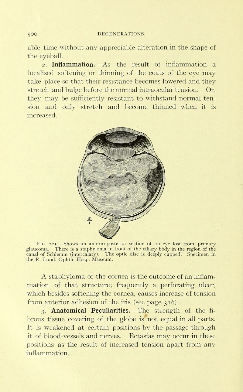 able time without any appreciable alteration in the shape of the eyeball. 2. Inflammation.—As the result of inflammation a localised softening or thinning of the coats of the eye may take place so that their resistance becomes lowered and they stretch and bulge before the normal intraocular tension. Or, the}.' may be sufficiently resistant to withstand normal ten- sion and only stretch and become thinned when it is increased. Fig. 221.—Shows an anterio-posterior section of an eye lost from primary glaucoma. There is a staphyloma in front of the ciliary body in the region of the canal of Schlemm (intercalary). The optic disc is deeply cupped. Specimen in the R. Lond. Ophth. Hosp. Museum. A staphyloma of the cornea is the outcome of an inflam- mation of that structure; frequently a perforating ulcer, which besides softening the cornea, causes increase of tension from anterior adhesion of the iris (see page 316). 3. Anatomical Peculiarities.—The strength of the fi- brous tissue covering of the globe is not equal in all parts. It is weakened at certain positions by the passage through it of blood-vessels and nerves. Ectasias may occur in these positions as the result of increased tension apart from any inflammation.