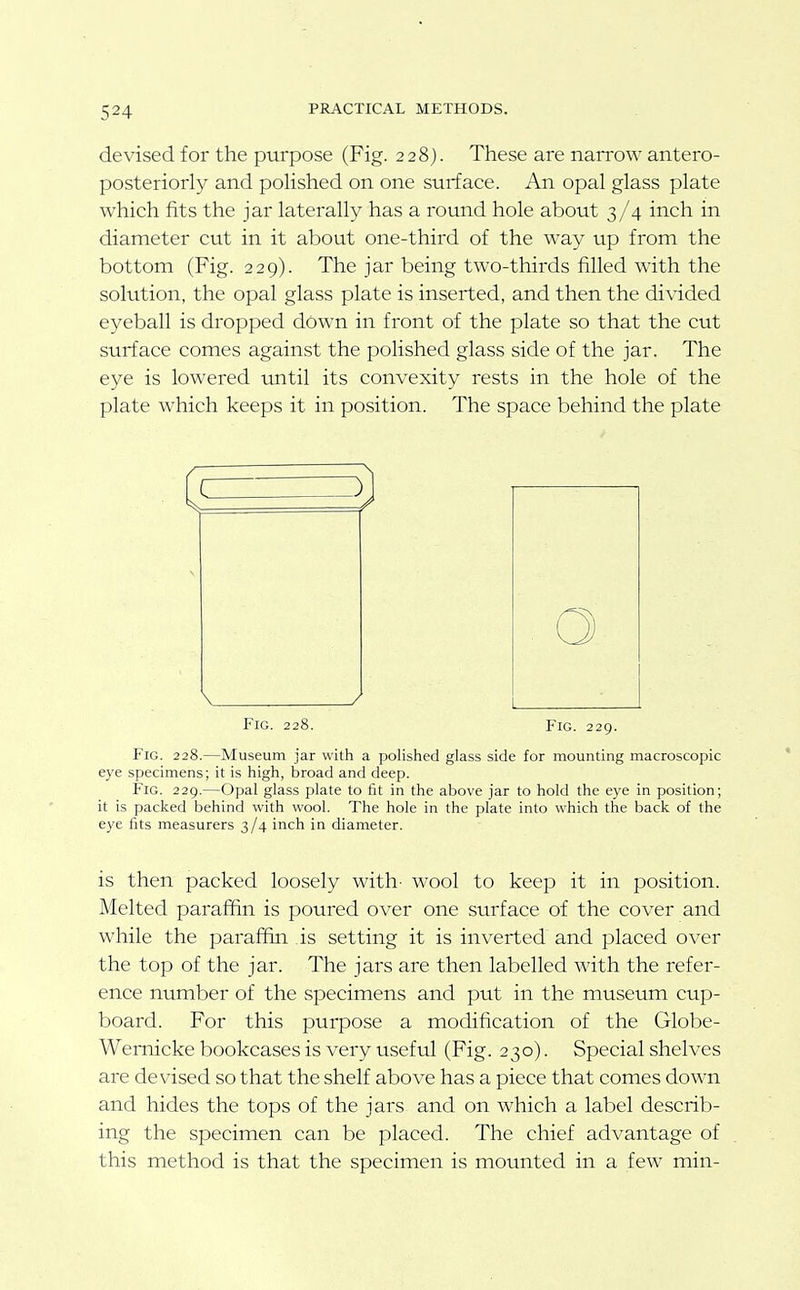 devised for the purpose (Fig. 228). These are narrow antero- posteriorly and polished on one surface. An opal glass plate which fits the jar laterally has a round hole about 3/4 inch in diameter cut in it about one-third of the way tip from the bottom (Fig. 229). The jar being two-thirds filled with the solution, the opal glass plate is inserted, and then the divided eyeball is dropped down in front of the plate so that the cut surface comes against the polished glass side of the jar. The eye is lowered until its convexity rests in the hole of the plate which keeps it in position. The space behind the plate \ / I Fig. 228. Fig. 229. Fig. 228.—Museum jar with a polished glass side for mounting macroscopic eye specimens; it is high, broad and deep. Fig. 229.—Opal glass plate to fit in the above jar to hold the eye in position; it is packed behind with wool. The hole in the plate into which the back of the eye fits measurers 3/4 inch in diameter. is then packed loosely with' wool to keep it in position. Melted paraffin is poured over one surface of the cover and while the paraffin is setting it is inverted and placed over the top of the jar. The jars are then labelled with the refer- ence number of the specimens and put in the museum cup- board. For this purpose a modification of the Globe- Wemicke bookcases is very useful (Fig. 230). Special shelves are devised so that the shelf above has a piece that comes down and hides the tops of the jars and on which a label describ- ing the specimen can be placed. The chief advantage of this method is that the specimen is mounted in a few min-