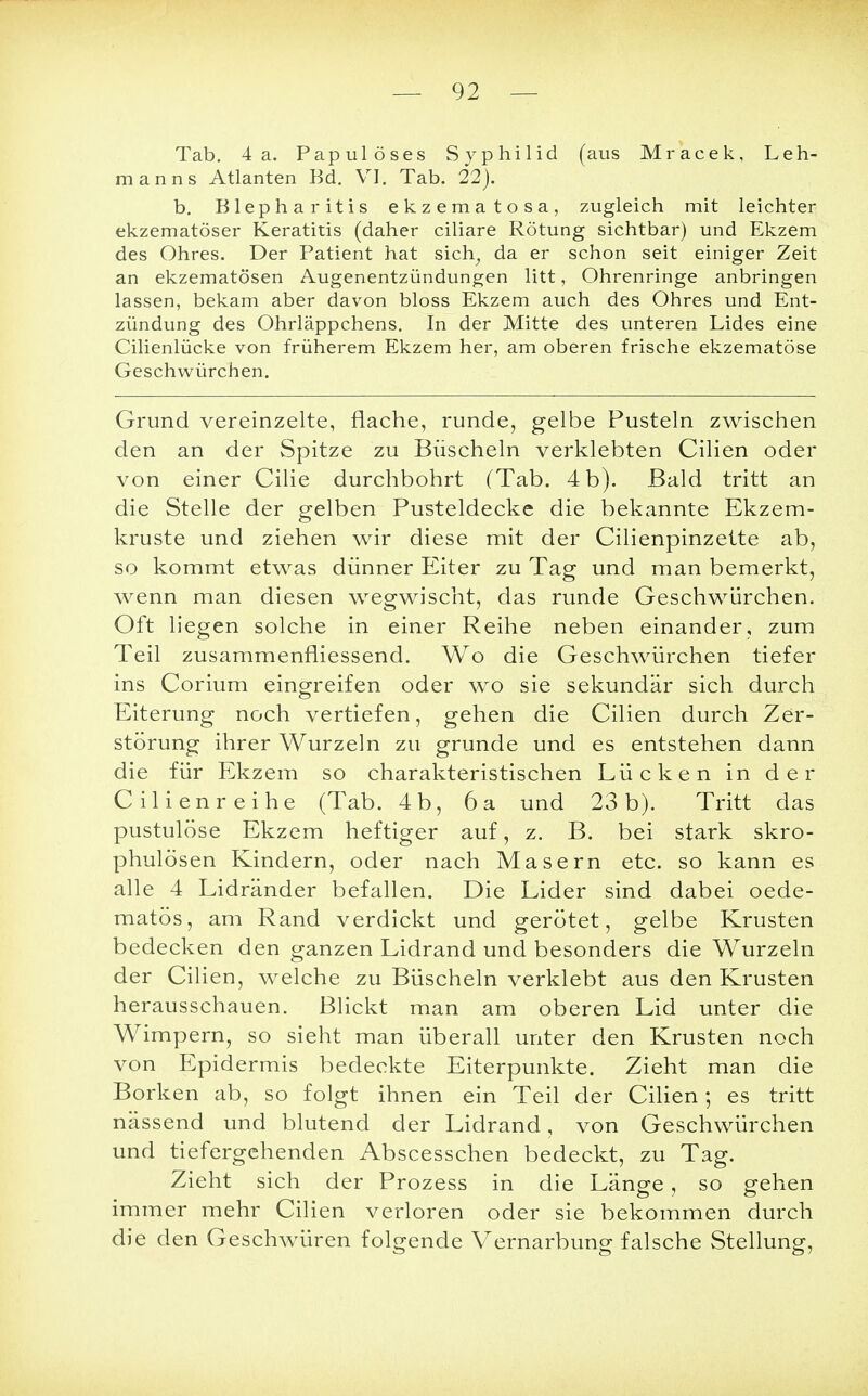 Tab. 4 a. Papulöses Syphilid (aus Mracek, Leh- manns Atlanten Bd. VI. Tab. 22). b. Blepharitis ekzematosa, zugleich mit leichter ekzematöser Keratitis (daher ciliare Rötung sichtbar) und Ekzem des Ohres. Der Patient hat sich,, da er schon seit einiger Zeit an ekzematösen Augenentzündungen litt, Ohrenringe anbringen lassen, bekam aber davon bloss Ekzem auch des Ohres und Ent- zündung des Ohrläppchens. In der Mitte des unteren Lides eine Cilienlücke von früherem Ekzem her, am oberen frische ekzematöse Geschwürchen. Grund vereinzelte, flache, runde, gelbe Pusteln zwischen den an der Spitze zu Büscheln verklebten Cilien oder von einer Cilie durchbohrt (Tab. 4 b). Bald tritt an die Stelle der gelben Pusteldecke die bekannte Ekzem- kruste und ziehen wir diese mit der Cilienpinzette ab, so kommt etwas dünner Eiter zu Tag und man bemerkt, wenn man diesen wegwischt, das runde Geschwürchen. Oft liegen solche in einer Reihe neben einander, zum Teil zusammenfliessend. Wo die Geschwürchen tiefer ins Corium eingreifen oder wo sie sekundär sich durch Eiterung noch vertiefen, gehen die Cilien durch Zer- störung ihrer Wurzeln zu gründe und es entstehen dann die für Ekzem so charakteristischen Lücken in der Cilienreihe (Tab. 4b, 6a und 23b). Tritt das pustulöse Ekzem heftiger auf, z. B. bei stark skro- phulösen Kindern, oder nach Masern etc. so kann es alle 4 Lidränder befallen. Die Lider sind dabei oede- matös, am Rand verdickt und gerötet, gelbe Krusten bedecken den ganzen Lidrand und besonders die Wurzeln der Cilien, welche zu Büscheln verklebt aus den Krusten herausschauen. Blickt man am oberen Lid unter die Wimpern, so sieht man überall unter den Krusten noch von Epidermis bedeckte Eiterpunkte. Zieht man die Borken ab, so folgt ihnen ein Teil der Cilien; es tritt nässend und blutend der Lidrand, von Geschwürchen und tiefergehenden Abscesschen bedeckt, zu Tag. Zieht sich der Prozess in die Länge, so gehen immer mehr Cilien verloren oder sie bekommen durch die den Geschwüren folgende Vernarbung falsche Stellung,