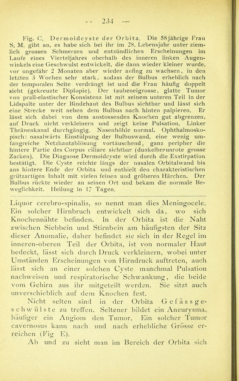 Fig. C. Dermoidcyste der Orbita. Die 58jährige Frau S. M. gibt an, es habe sich bei ihr im 28. Lebensjahr unter ziem- lich grossen Schmerzen und entzündlichen Erscheinungen im Laufe eines Vierteljahres oberhalb des inneren linken Augen- winkels eine Geschwulst entwickelt, die dann wieder kleiner wurde, vor ungefähr 2 Monaten aber wieder anfing zu wachsen, in den letzten 3 Wochen sehr stark, sodass der Bulbus erheblich nach der temporalen Seite verdrängt ist und die Frau häufig doppelt sieht (gekreuzte Diplopie). Der taubeneigrosse, glatte Tumor von prall-elastischer Konsistenz ist mit seinem unteren Teil in der Lidspalte unter der Bindehaut des Bulbus sichtbar und lässt sich eine Strecke weit neben dem Bulbus nach hinten palpieren. Er lässt sich dabei von dem anstossenden Knochen gut abgrenzen, auf Druck nicht verkleinern und zeigt keine Pulsation. Linker Thränenkanal durchgängig. Nasenhöhle normal. Ophthalmosko- pisch: nasalwärts Einstülpung der Bulbuswand, eine wenig um- fangreiche Netzhautablösung vortäuschend, ganz peripher die hintere Partie des Corpus ciliare sichtbar (dunkelbraunrote grosse Zacken). Die Diagnose Dermoidcyste wird durch die Exstirpation bestätigt. Die Cyste reichte längs der nasalen Orbitalwand bis ans hintere Ende der Orbita und enthielt den charakteristischen grützartigen Inhalt mit vielen feinen und gröberen Härchen. Der Bulbus rückte wieder an seinen Ort und bekam die normale Be- weglichkeit. Heilung in 1/ Tagen. Liquor cerebrospinalis, so nennt man dies Meningocele. Ein solcher Hirnbruch entwickelt sich da, wo sich Knochennähte befinden. In der Orbita ist die Naht zwischen Siebbein und Stirnbein am häufigsten der Sitz dieser Anomalie, daher befindet sie sich in der Regel im inneren-oberen Teil der Orbita, ist von normaler Haut bedeckt, lässt sich durch Druck verkleinern, wobei unter Umständen Erscheinungen von Hirndruck auftreten, auch lässt sich an einer solchen Cyste manchmal Pulsation nachweisen und respiratorische Schwankung, die beide vom Gehirn aus ihr mitgeteilt werden. Sie sitzt auch imverschieblich auf dem Knochen fest. Nicht selten sind in der Orbita Gefässge- schwülste zu treffen. Seltener bildet ein Aneurysma, häufiger ein Angiom den Tumor. Ein solcher Tumor cavernosus kann nach und nach erhebliche Grösse er- reichen (Fig E). Ab und zu sieht man im Bereich der Orbita sich