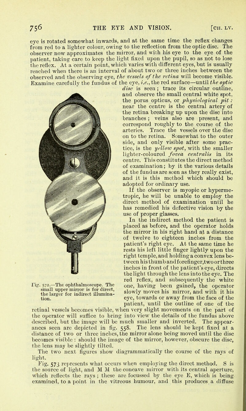 eye is rotated somewhat inwards, and at the same time the reflex changes from red to a lighter colour, owing to the reflection from the optic disc. The observer now approximates the mirror, and wiih his eye to the eye of the patient, taking care to keep the light fixed upon the pupil, so as not to lose the reflex. At~a certain point, which varies with different eyes, but is usually reached when there is an interval of about two or three inches between the observed and the observing eye, the vessels of the retina will become visible. Examine carefully the fundus of the eye, i.e., the red surface—until the optic disc is seen ; trace its circular outline, and observe the small central white spot, the porus opticus, or physiological pit: near the centre is the central artery of the retina breaking up upon the disc into branches ; veins also are present, and correspond roughly to the course of the arteries. Trace the vessels over the disc on to the retina. Somewhat to the outer side, and only visible after some prac- tice, is the yellow spot, with the smaller lighter-coloured fovea centralis in its centre. This constitutes the direct method of examination; by it the various details of the fundus are seen as they really exist, and it is this method which should be adopted for ordinary use. If the observer is myopic or hyperme- tropic, he will be unable to employ the direct method of examination until he has remedied his defective vision by the use of proper glasses. In the indirect method the patient is placed as before, and the operator holds the mirror in his right hand at a distance of twelve to eighteen inches from the patient's right eye. At the same time he rests his left little finger lightly upon the right temple, and holding a convex lens be- tween his thumb andforefinger,two or three inches in front of the patient's eye, directs the light through the lens into the eye. The red reflex, and subsequently the white one, having been gained, the operator slowly moves his mirror, and with it his eye, towards or away from the face of the patient, until the outline of one of the retinal vessels becomes visible, when very slight movements on the part of the operator will suffice to bring into view the details of the fundus above described, but the image wall be much smaller and inverted. The appear- ances seen are depicted in fig. 558. The lens should be kept fixed at a distance of twro or three inches, the mirror alone being moved until the disc becomes visible : should the image of the mirror, however, obscure the disc, the lens may be slightly tilted. The two next figures show diagrammatically the course of the rays of light. Fig. 573 represents what occurs when employing the direct method. S is the source of light, and M M the concave mirror with its central aperture, which reflects the rays ; these are focussed by the eye E, which is being examined, to a point in the vitreous humour, and this produces a diffuse rig. 572.—The ophthalmoscope. The small upper mirror is for direct, the larger for indirect illumina- tion.