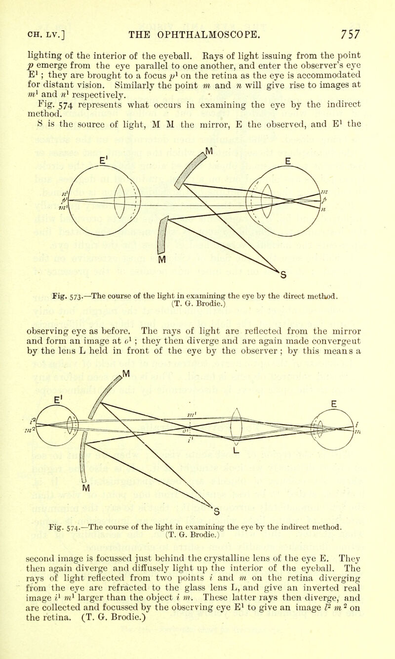 lighting of the interior of the eyeball. Rays of light issuing from the point p emerge from the eye parallel to one another, and enter the observer's eye E1 ; they are brought to a focus p1 on the retiua as the eye is accommodated for distant vision. Similarly the point m and 11 will give rise to images at m1 and ri* respectively. Fig. 574 represents what occurs in examining the eye by the indirect method. S is the source of light, M M the mirror, E the observed, and E1 the Fig* 573-—The course of the light in examining the eye by the direct method. (T. G. Brodie.) observing eye as before. The rays of light are reflected from the mirror and form an image at o1 ; they then diverge and are again made convergeut by the lens L held in front of the eye by the observer ; by this means a Fig. 574.—The course of the light in examining the eye by the indirect method. (T. G. Brodie.) second image is focussed just behind the crystalline lens of the eye E. They then again diverge and diffusely light up the interior of the eyeball. The rays of light reflected from two points i and m. on the retina diverging from the eye are refracted to the glass lens L, and give an inverted real image i1 m1 larger than the object i m. These latter rays then diverge, and are collected and focussed by the observing eye E1 to give an image I2 m 2 on the retina. (T. G-. Brodie.)