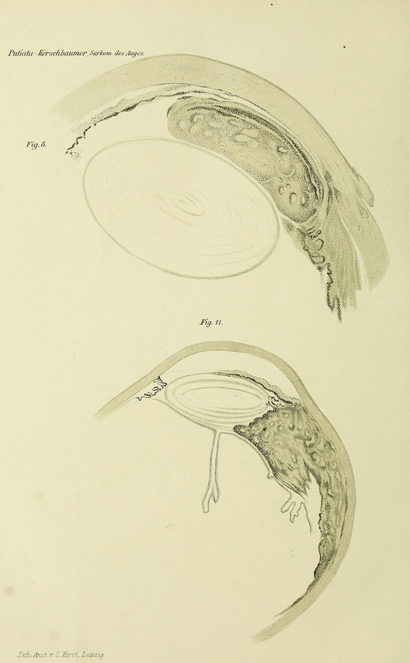 Ihiiktta - Eh^schhaum^ des Auges. I,it)v.Anst.T. C.Mrst, Leipzig.