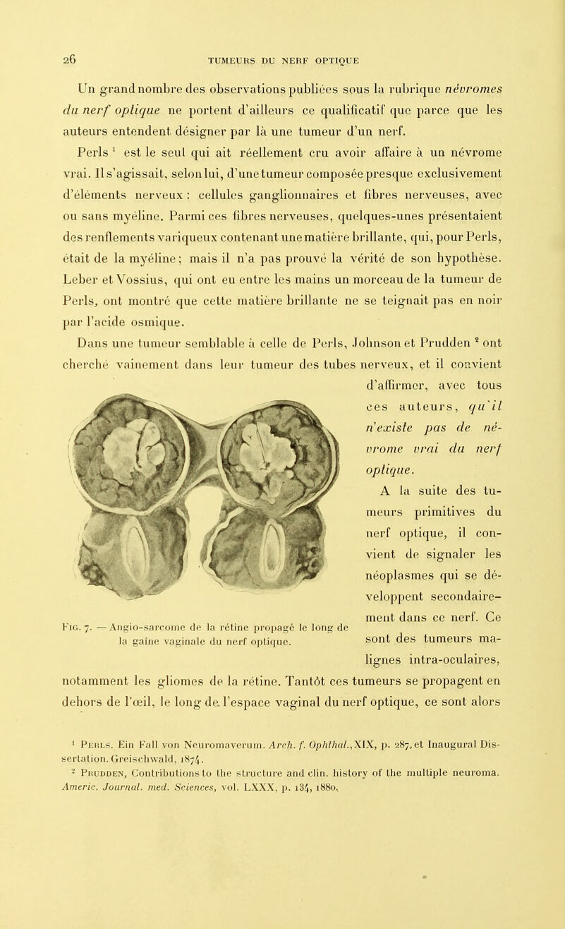 Un grand nombre des observations publiées sous la rubrique névromes du nerf optique ne portent d'ailleurs ce qualificatif que parce que les auteurs entendent désigner par là une tumeur d'un nerf. Péris 1 est le seul qui ait réellement cru avoir affaire à un névrome vrai. Il s'agissait, selon lui, d'une tumeur composée presque exclusivement d'éléments nerveux : cellules ganglionnaires et fibres nerveuses, avec ou sans myéline. Parmi ces fibres nerveuses, quelques-unes présentaient des renflements variqueux contenant une matière brillante, qui, pour Péris, était de la myéline; mais il n'a pas prouvé la vérité de son hypotbèse. Leber et Vossius, qui ont eu entre les mains un morceau de la tumeur de Péris, ont montre que cette matière brillante ne se teignait pas en noir par l'acide osmique. Dans une tumeur semblable à celle de Péris, Jobnsonet Prudden 2 ont cherché vainement dans leur tumeur des tubes nerveux, et il convient d'affirmer, avec tous ces auteurs, qu'il ri existe pas de né- vrome vrai du nerf optique. A la suite des tu- meurs primitives du nerf optique, il con- vient de signaler les néoplasmes qui se dé- veloppent secondaire- ment dans ce nerf. Ce Fig. 7. — Angio-sarcome de la rétine propagé le long de la gaine vaginale du nerf optique. sont des tumeurs ma- lignes intra-oculaires, notamment les gliomes de la rétine. Tantôt ces tumeurs se propagent en dehors de l'œil, le long de. l'espace vaginal du nerf optique, ce sont alors 1 Perls. Ein Fall von Neuromaverum. Arch. f. Ophthal.,XlX, p. 287,et Inaugural Dis- sertation. Greischwald, 1874. 3 Prudden, Contributions to the structure and clin, history of the multiple neuroma. Americ. Journal, med. Sciences, vol. LXXX, p. i34, 1880*