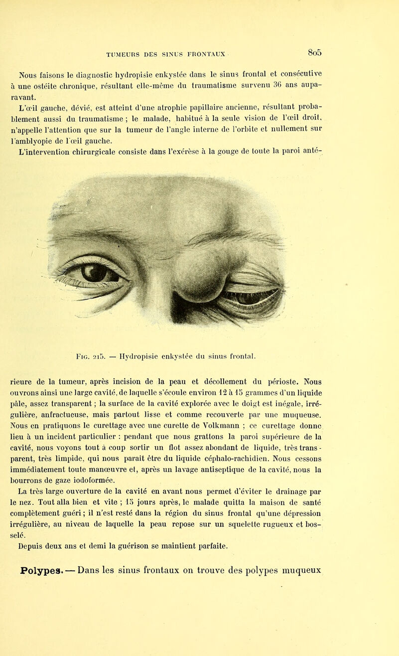 Nous faisons le diagnostic hydropisie enkyslée dans le sinus frontal et consécutive à une ostéite chronique, résultant elle-même du traumatisme survenu 36 ans aupa- ravant. L'œil gauche, dévié, est atteint d'une atrophie papillaire ancienne, résultant proba- hlement aussi du traumatisme ; le malade, habitué à la seule vision de l'œil droit, n'appelle l'attention que sur la tumeur de l'angle interne de l'orbite et nullement sur l'amblyopie de l'œil gauche. L'intervention chirurgicale consiste dans l'exérèse à la gouge de toute la paroi anté- Fig. 2i5. — Hydropisie enkystée du sinus frontal. rieure de la tumeur, après incision de la peau et décollement du périoste. Nous ouvrons ainsi une large cavité, de laquelle s'écoule environ 12 à 15 grammes d'un liquide pâle, assez transparent ; la surface de la cavité explorée avec le doigt est inégale, irré- gulière, anfractueuse, mais partout lisse et comme recouverte par une muqueuse. Nous en pratiquons le curettage avec une curette de Volkmann ; ce curettage donne lieu à un incident particulier : pendant que nous grattons la paroi supérieure de la cavité, nous voyons tout à coup sortir un flot assez abondant de liquide, très trans- parent, très limpide, qui nous paraît être du liquide céphalo-rachidien. Nous cessons immédiatement toute manœuvre et, après un lavage antiseptique de la cavité, nous la bourrons de gaze iodoformée. La très large ouverture de la cavité en avant nous permet d'éviter le drainage par le nez. Tout alla bien et vite ; 13 jours après, le malade quitta la maison de santé complètement guéri ; il n'est resté dans la région du sinus frontal qu'une dépression irrégulière, au niveau de laquelle la peau repose sur un squelette rugueux et bos- selé. Depuis deux ans et demi la guérison se maintient parfaite. Polypes. — Dans les sinus frontaux on trouve des polypes muqueux