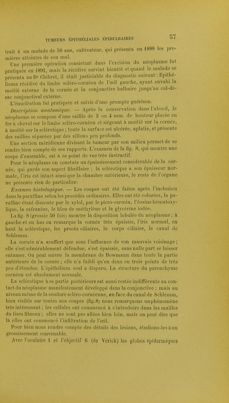 Irait ii un malade de 58 ans, cultivateur, qui présenta en 1888 les pre- mières atteintes de son mal. Une première opération consistant dans l'excision du néoplasme fut pratiquée en 1891, mais la récidive survint bientôt etquand le malade se présenta au Dr Chibret, il étail justiciable du diagnostic suivant : Epithé- lioma récidive du limbe scléro-cornéen de l'œil gauche, avant envahi la moitié externe de la cornée et la conjonctive bulbaire jusqu'au eul-dc- sac conjonctival externe. L'énucléalion fut pratiquée et suivie d'une prompte guérison. Description anatomique. — Après la conservation dans l'alcool, le néoplasme se compose d'une saillie de 3 ou 4 mm. de bailleur placée en 1er à cheval sur le limbe scléro-cornéen et siégeant à moitié sur la cornée, à moitié sur la sclérotique ; toute la surface est ulcérée, aplatie, et présente des saillies séparées par des sillons peu profonds. Une section méridienne divisant la tumeur par son milieu permet de se rendre bien compte de ses rapports. L'examen de la flg. 8, qui montre une coupe d'ensemble, est à ce point de vue très instructif. Pour le néoplameon constate unépaississement considérable delà cor- née, qui garde son aspect fibrillaire ; la sclérotique a son épaisseur nor- male,, l'iris est intact ainsi que la chambre antérieure, le reste de l'organe ne présente rien de particulier: Examen histologique. — Les coupes ont été faites après l'inclusion dans la paraffine selon les procédés ordinaires. Elles ont été colorées,, la pa- raffine étant dissoute par le xyloL par le picro-carmin, l'éosine hématoxy- lique, la safranine, le bleu de méthylène et la glycérine iodée. La fig. 8 (grossie 50 fois) montre la disposition lobuléedu néoplasme; à gauche et en bas on remarque la cornée très épaissie, l'iris normal, en haut la sclérotique, les procès ciliaires, le corps ciliaire, le canal de Schlemm. La cornée n'a souffert que sous l'influence de son mauvais voisinage ; elle s'est admirablement défendue, s'est épaissie, sans nulle part se laisser entamer. On peut suivre la membrane de Bowmann dans toute la partie antérieure de la cornée ; elle n'a faibli qu'en deux ou trois points de très peu d'étendue. L'épithélium seul a disparu. La structure du parenchyme cornéen est absolument normale. La sclérotique à sa partie postérieure est aussi restée indifférente au con- tact du néoplasme manifestement développé dans la conjonctive ; mais au niveau même de la soudure scléro-cornéenne, en face du canal de Schlemm, bien visible sur toutes nos coupes (fig.8j nous remarquons un phénomène très intéressant ; les cellules ont commencé à s'introduire dans les mailles du tissu fibreux ; elles ne sont pas allées bien loin, mais on peut dire que là elles ont commencé l'infiltration de l'œil. Pour bien nous rendre compte des détails des lésions, étudions-les a un grossissement convenable.