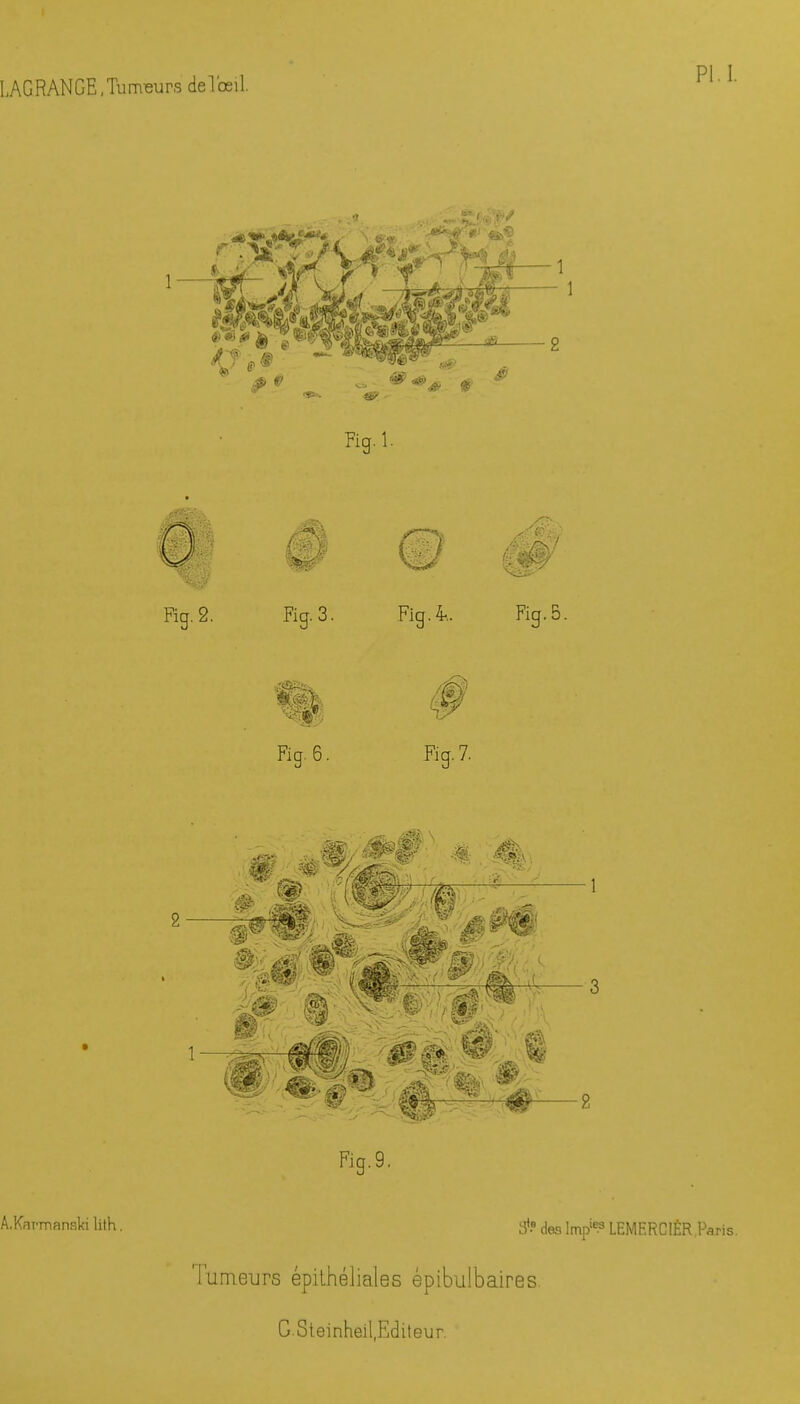 Pl.l. Rg.l. Fig. 2. w % 3. Fig.4*.. Fig. 5 Fig. 6. /il' Fig. 7. SI. fil 9% M t^r ,1 1 ?3jr£ SS'/ Fig.9. A.KarmanRki lith. 3»? des lmpie.9 LEMERCIÊR,Paris. Tumeurs épithéliales épibulbaires.