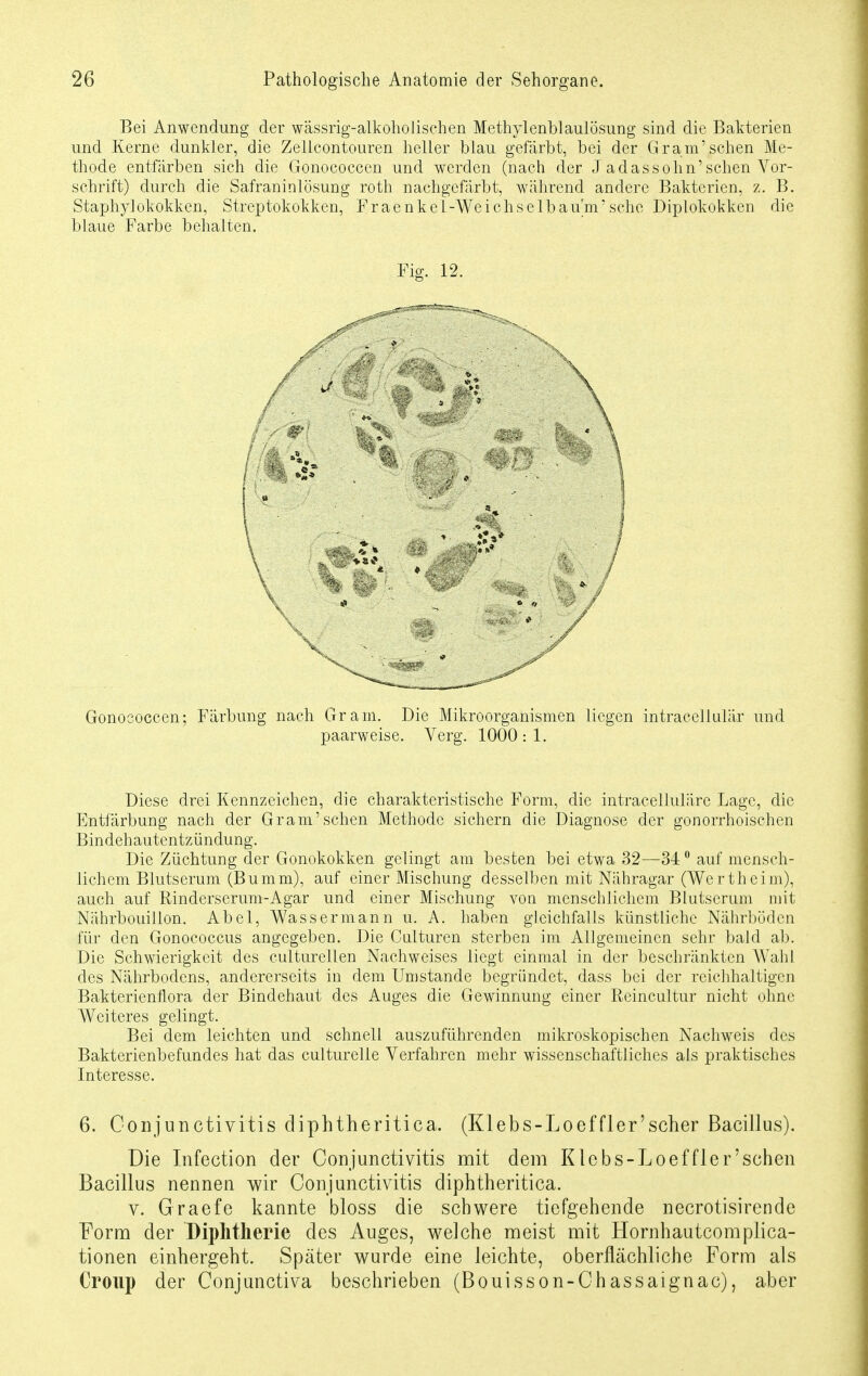 Bei Anwendung der wässrig-alkoholischen Methylenblaulösung sind die Bakterien und Kerne dunkler, die Zellcontouren heller blau gefärbt, bei der Gram'sehen Me- thode entfärben sich die Gonococcen und werden (nach der ,1 adassohn'sehen Vor- schrift) durch die Safraninlösung roth nachgefärbt, während andere Bakterien, z. B. Staphylokokken, Streptokokken, Fraenkel-Weichselbaum'seho Diplokokken die blaue Farbe behalten. Fig. 12. Gonococcen; Färbung nach Gram. Die Mikroorganismen liegen intracellulär und paarweise. Verg. 1000:1. Diese drei Kennzeichen, die charakteristische Form, die intracelluläre Lage, die Entfärbung nach der Gram'sehen Methode sichern die Diagnose der gonorrhoischen Bindehautentzündung. Die Züchtung der Gonokokken gelingt am besten bei etwa 32—340 auf mensch- lichem Blutserum (Bumm), auf einer Mischung desselben mit Nähragar (Wertheim), auch auf Rinderserum-Agar und einer Mischung von menschlichem Blutserum mit Nährbouillon. Abel, Wassermann u. A. haben gleichfalls künstliche Nährböden für den Gonococcus angegeben. Die Culturen sterben im Allgemeinen sehr bald ab. Die Schwierigkeit des culturellen Nachweises liegt einmal in der beschränkten Wahl des Nährbodens, andererseits in dem Umstände begründet, dass bei der reichhaltigen Bakterienflora der Bindehaut des Auges die Gewinnung einer Reincultur nicht ohne Weiteres gelingt. Bei dem leichten und schnell auszuführenden mikroskopischen Nachweis des Bakterienbefundes hat das culturelle Verfahren mehr wissenschaftliches als praktisches Interesse. 6. Conjunctivitis diphtheritica. (Klebs-Loeffler'scher Bacillus). Die Infection der Conjunctivitis mit dem Klebs-Loeffler'sehen Bacillus nennen wir Conjunctivitis diphtheritica. v. Graefe kannte bloss die schwere tiefgehende necrotisirende Form der Diphtherie des Auges, welche meist mit Hornhautcomplica- tionen einhergeht. Später wurde eine leichte, oberflächliche Form als Croup der Conjunctiva beschrieben (Bouisson-Chassaignae), aber