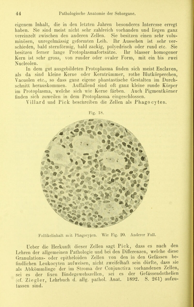 eigenem Inhalt, die in den letzten Jahren besonderes Interesse erregt haben. Sie sind meist nicht sehr zahlreich vorhanden und liegen ganz vereinzelt zwischen den anderen Zellen. Sie besitzen einen sehr volu- minösen, unregelmässig geformten Leib. Ihr Aussehen ist sehr ver- schieden, bald sternförmig, bald zackig, polyedrisch oder rund etc. Sie besitzen ferner lange Protoplasmafortsätze. Ihr blasser homogener Kern ist sehr gross, von runder oder ovaler Form, mit ein bis zwei Nucleolen. In dem gut ausgebildeten Protoplasma finden sich meist Enclaven, als da sind kleine Kerne oder Kerntrümmer, rothe Blutkörperchen, Vacuolen etc., so dass ganz eigene phantastische Gestalten im Durch- schnitt herauskommen. Auffallend sind oft ganz kleine runde Körper im Protoplasma, welche sich wie Kerne färben. Auch Pigmentkörner finden sich zuweilen in dem Protoplasma eingeschlossen. Villard und Pick beschreiben die Zellen als Phago cyten. Fig. i8. , > V v^ • •. . -l I % Follikelinhalt mit Phagocyfen. Wie Fig. 20. Anderer Fall. üeber die Herkunft dieser Zellen sagt Pick, dass es nach den Lehren der allgemeinen Pathologie und bei den Differenzen, welche diese Granulations- oder epitheloiden Zellen von den in den Gefässen be- findlichen Leukocyten aufweisen, nicht zweifelhaft sein dürfte, dass sie als Abkömmlinge der im Stroma der Conjunctiva vorhandenen Zellen, sei es der fixen Bindegewebszellen, sei es der Gefässendothelien (cf. Ziegler, Lehrbuch d. allg. pathol. Anat. 1892. S. 261) aufzu- fassen sind.