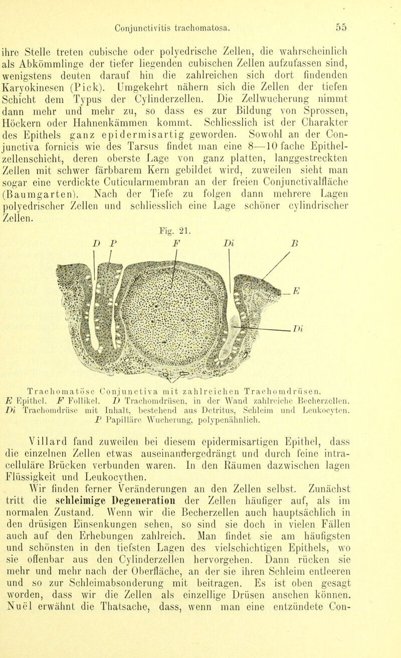 ihre Stelle treten cubische oder polyedrische Zellen, die wahrscheinlich als Abkömmlinge der tiefer liegenden cubischen Zellen aufzufassen sind, wenigstens deuten darauf hin die zahlreichen sich dort findenden Karyokinesen (Pick). Umgekehrt nähern sich die Zellen der tiefen Schicht dem Typus der Cylinderzellen. Die Zellwucherung nimmt dann mehr und mehr zu, so dass es zur Bildung von Sprossen, Höckern oder Hahnenkämmen kommt. Schliesslich ist der Charakter des Epithels ganz epidermisartig geworden. Sowohl an der Con- junctiva fornicis wie des Tarsus findet man eine 8—10 fache Epithel- zellenschicht, deren oberste Lage von ganz platten, langgestreckten Zellen mit schwer färbbarem Kern gebildet wird, zuweilen sieht man sogar eine verdickte Cuticularmembran an der freien Conjunctivalfläche (Baumgarten). Nach der Tiefe zu folgen dann mehrere Lagen polyedrischer Zellen und schliesslich eine Lage schöner cylindrischer Zellen. Fig. 21. DP F Di B Trachomatöse Conjunctiva mit zahlreichen Trachomdrüsen. E Epithel. F Follikel. D Trachomdrüsen, in der Wand zahlreiche Becherzellen. Di Trachomdrüse mit Inhalt, bestehend aus Detritus, Schleim und Leukocyten. P Papilläre Wucherung, polypenähnlich. Villard fand zuweilen bei diesem epidermisartigen Epithel, dass die einzelnen Zellen etwas auseinandergedrängt und durch feine intra- celluläre Brücken verbunden waren. In den Räumen dazwischen lagen Flüssigkeit und Leukocythen. Wir finden ferner Veränderungen an den Zellen selbst. Zunächst tritt die schleimige Degeneration der Zellen häufiger auf, als im normalen Zustand. Wenn wir die Becherzellen auch hauptsächlich in den drüsigen Einsenkungen sehen, so sind sie doch in vielen Fällen auch auf den Erhebungen zahlreich. Man findet sie am häufigsten und schönsten in den tiefsten Lagen des vielschichtigen Epithels, wo sie offenbar aus den Cylinderzellen hervorgehen. Dann rücken sie mehr und mehr nach der Oberfläche, an der sie ihren Schleim entleeren und so zur Schleimabsonderung mit beitragen. Es ist oben gesagt worden, dass wir die Zellen als einzellige Drüsen ansehen können. Nuel erwähnt die Thatsache, dass, wenn man eine entzündete Con-